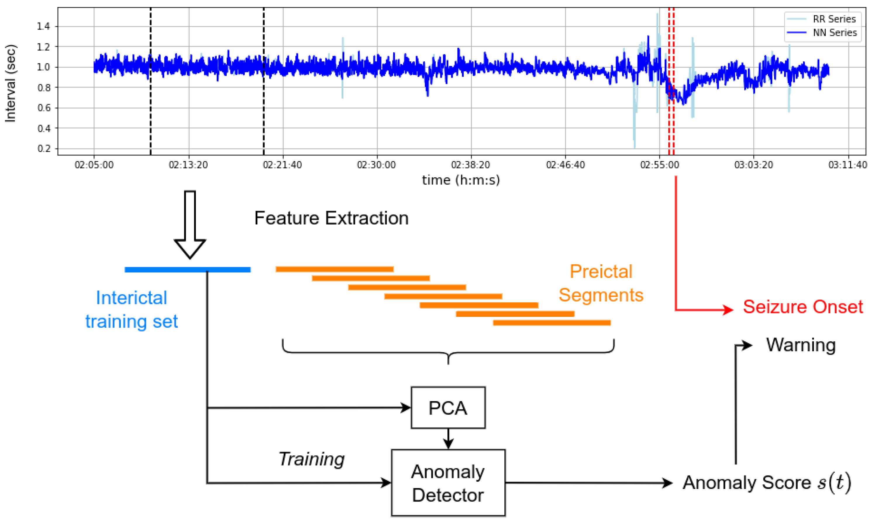 ECG-Based Semi-Supervised Anomaly Detection for Early Detection 