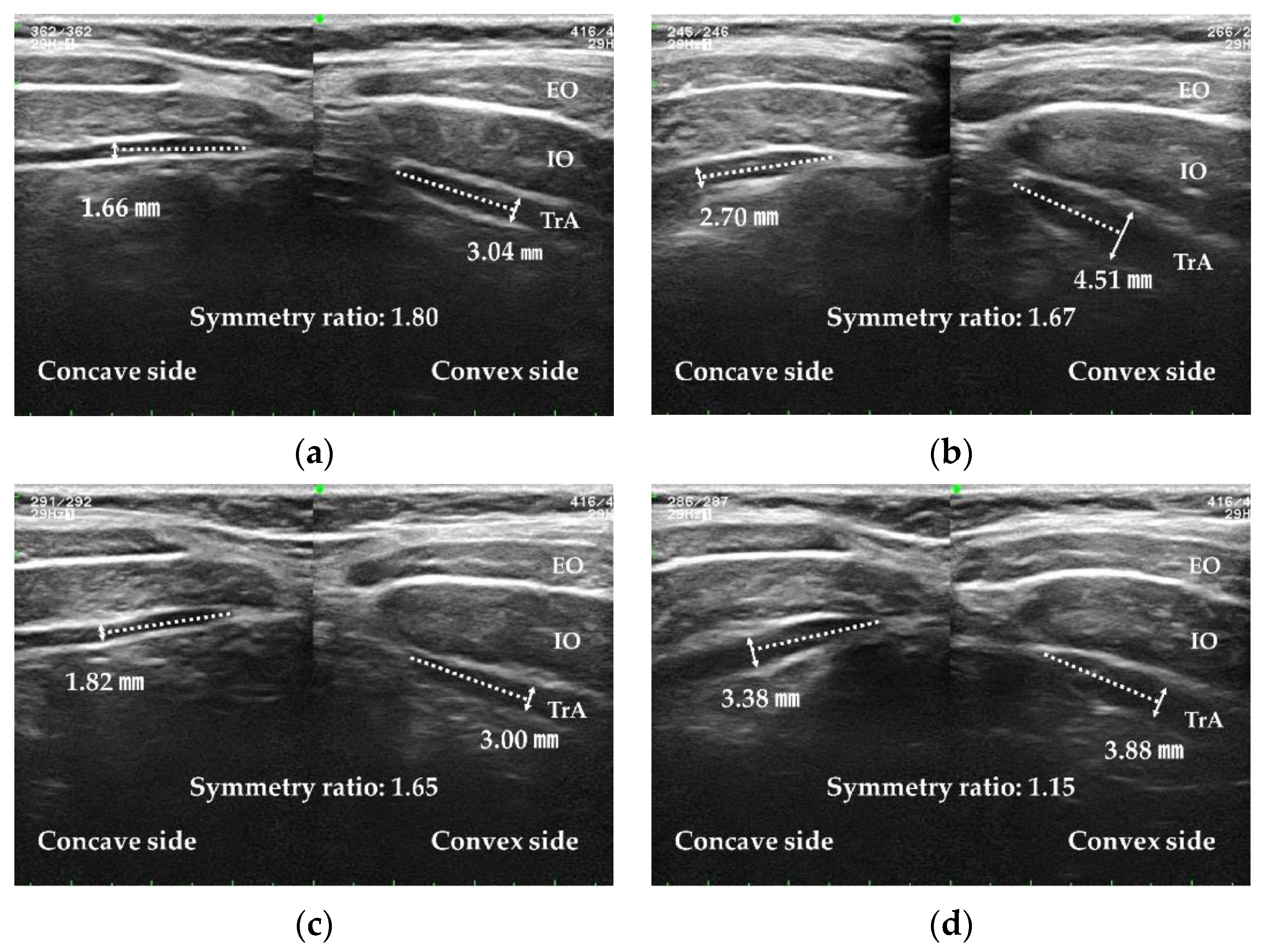 Ijerph 20 05016 g004