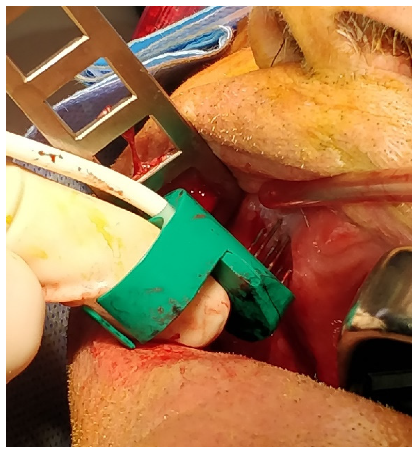 Ijerph 20 05170 g001 Ijerph 20 05170 g001