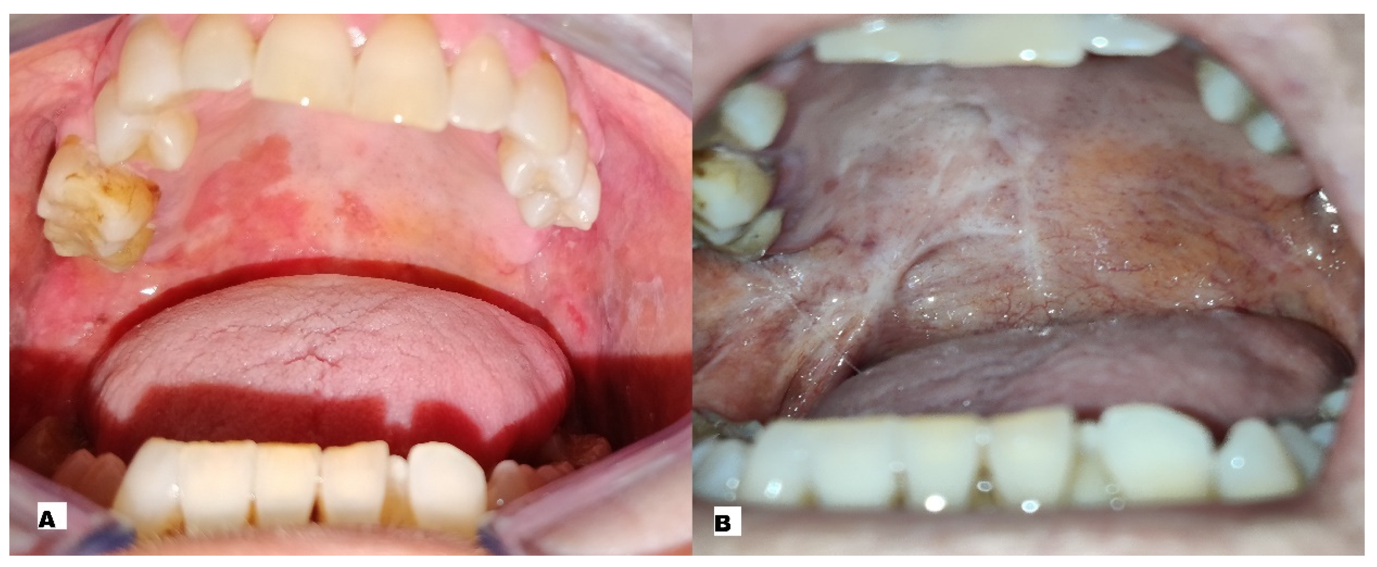 Ijerph 20 05170 g002 Ijerph 20 05170 g002