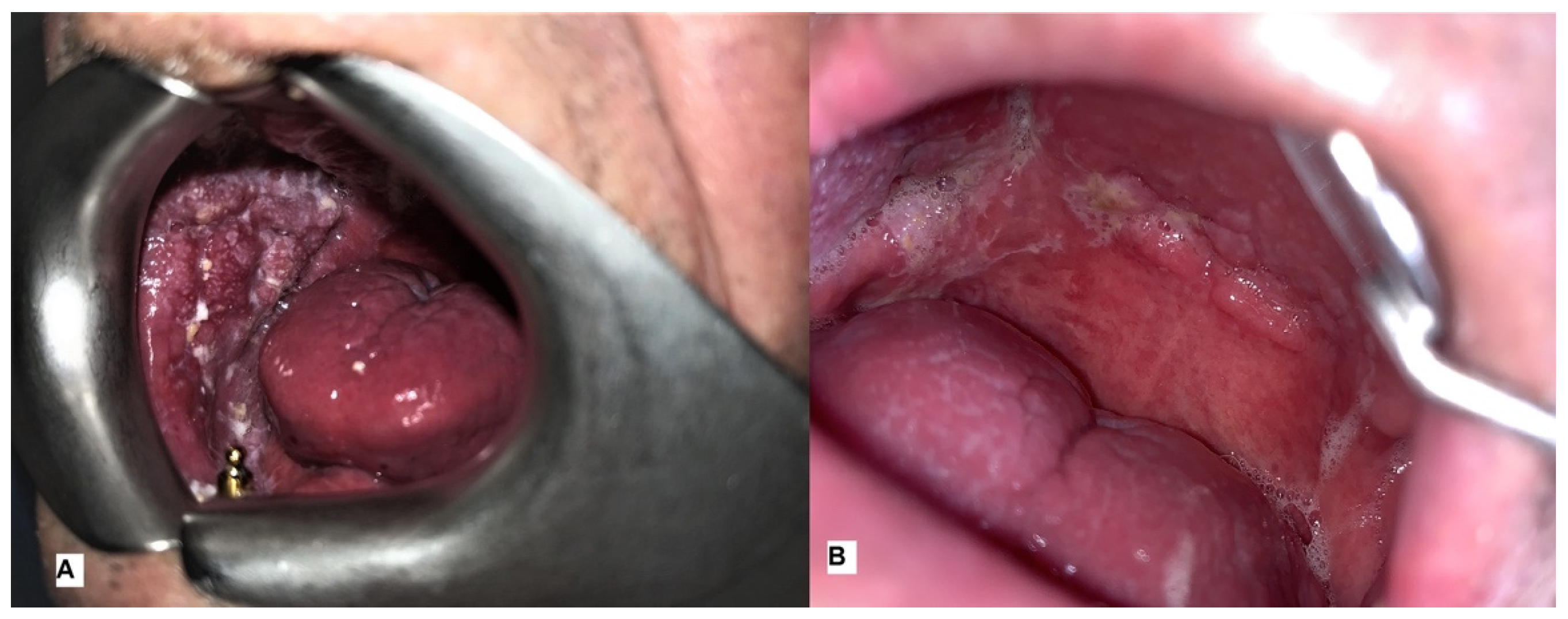 Ijerph 20 05170 g003 Ijerph 20 05170 g003