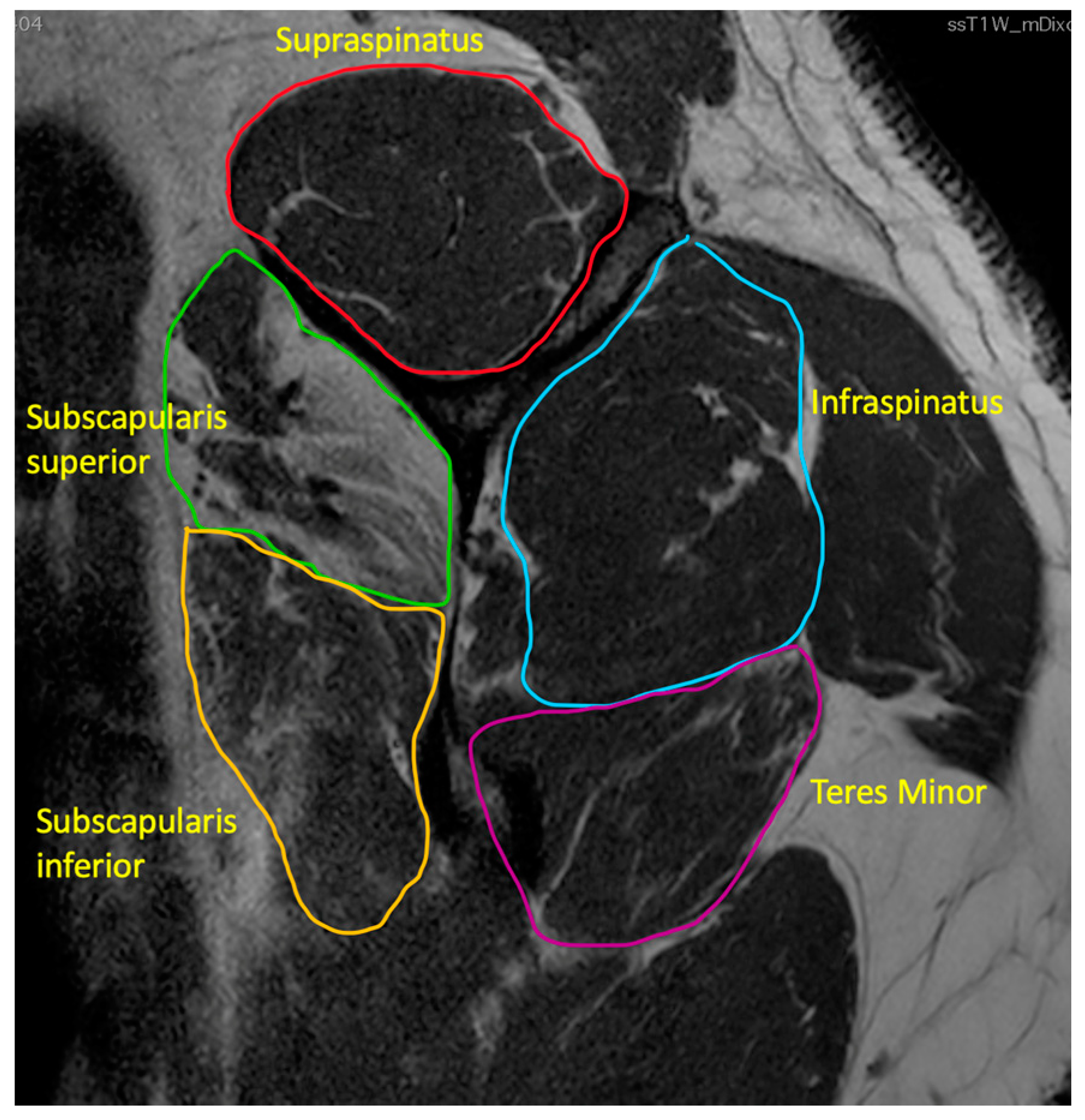 Ijerph 20 05242 g002 Ijerph 20 05242 g002