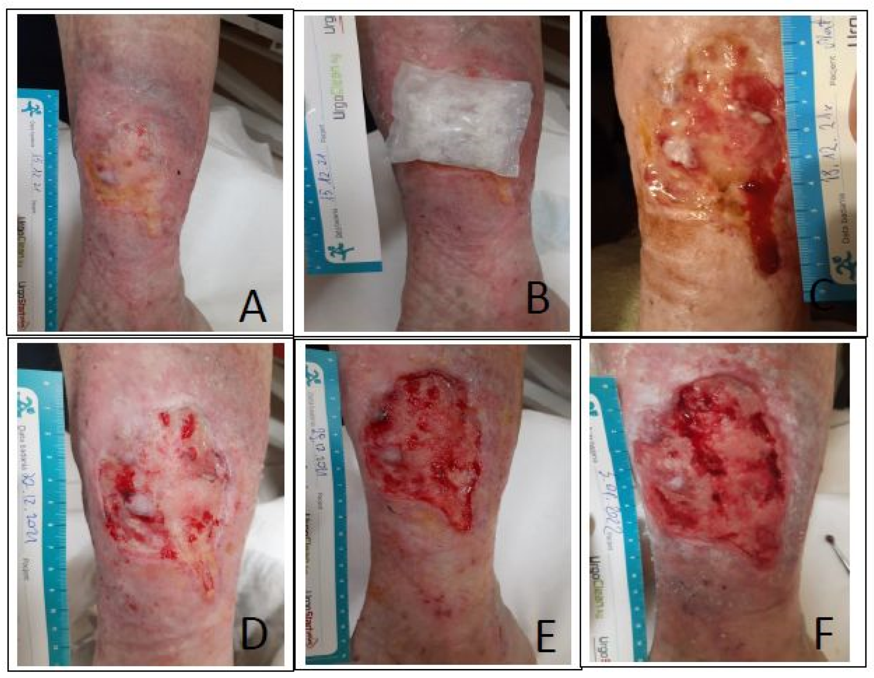 Ijerph 20 05357 g001