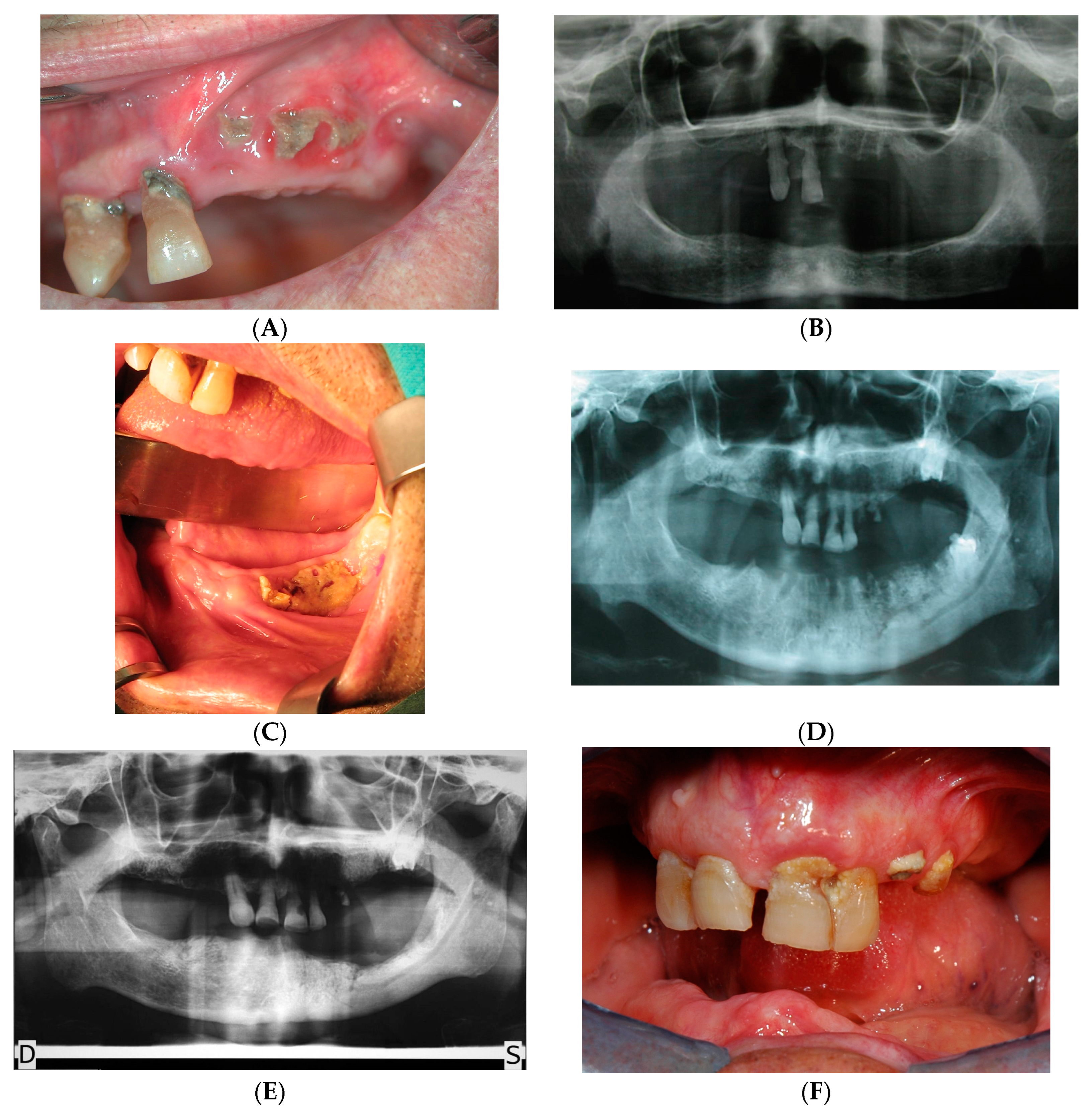Ijerph 20 05402 g003