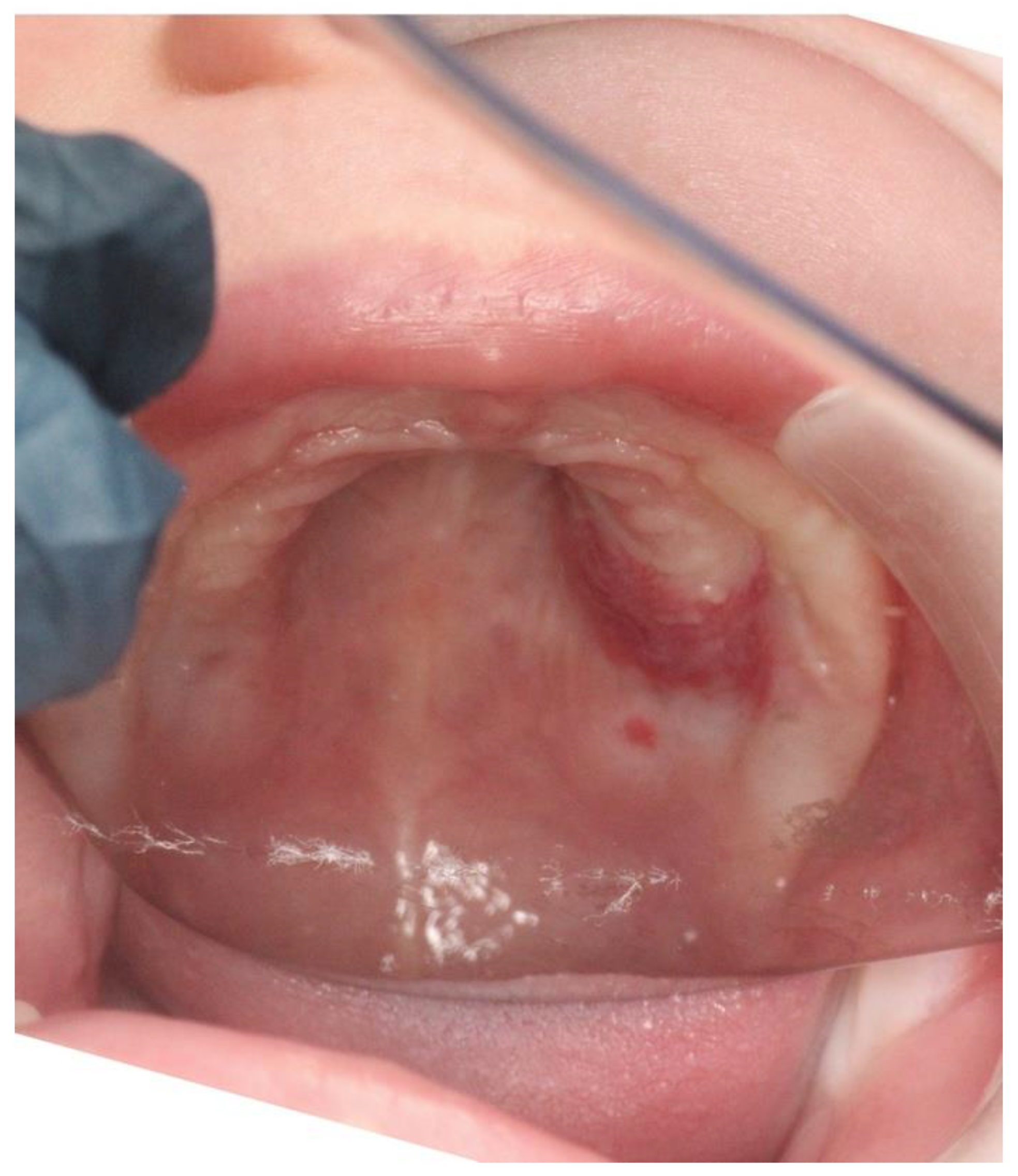 Ijerph 20 05585 g001