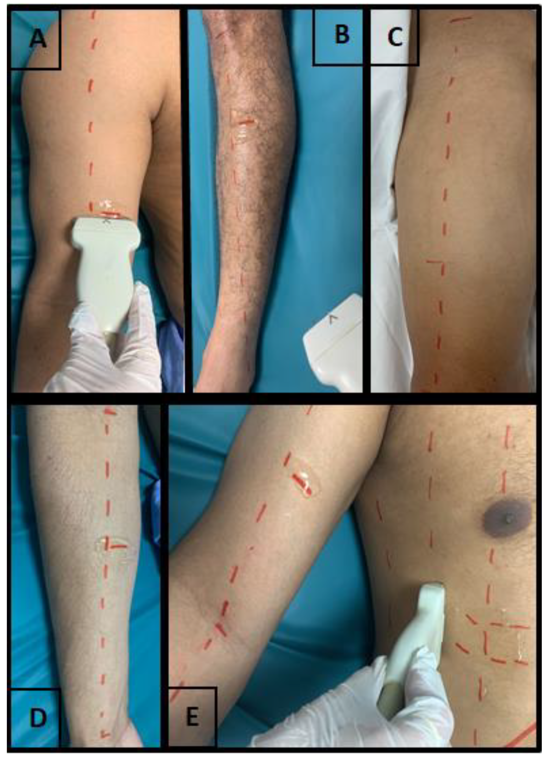 Ijerph 20 05636 g001