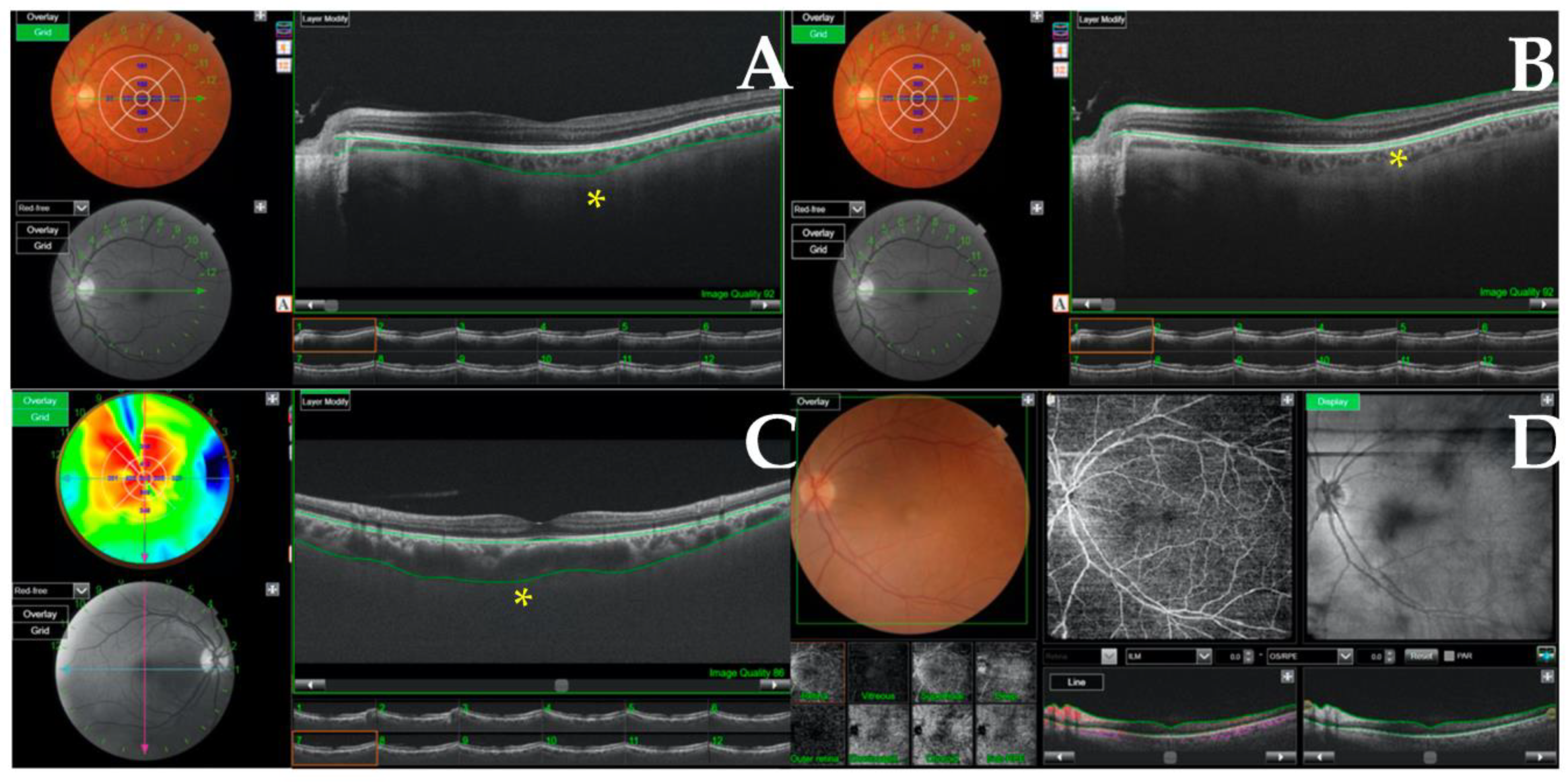 Ijerph 20 05659 g001