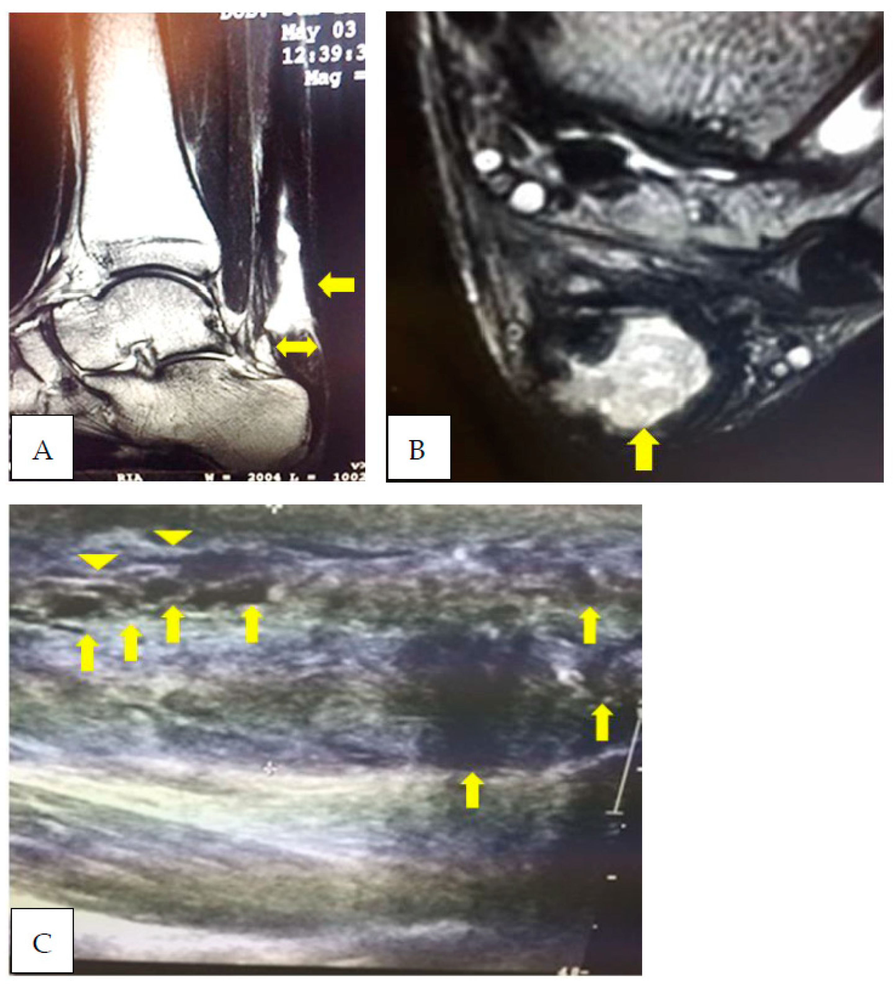Ijerph 20 05985 g002