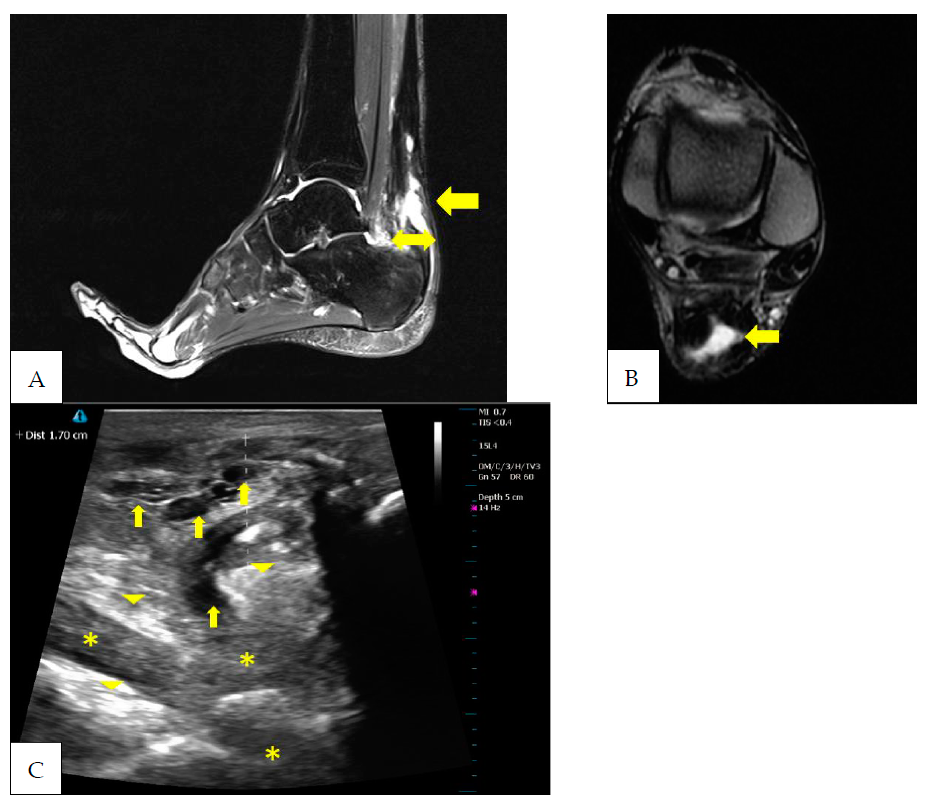 Ijerph 20 05985 g003