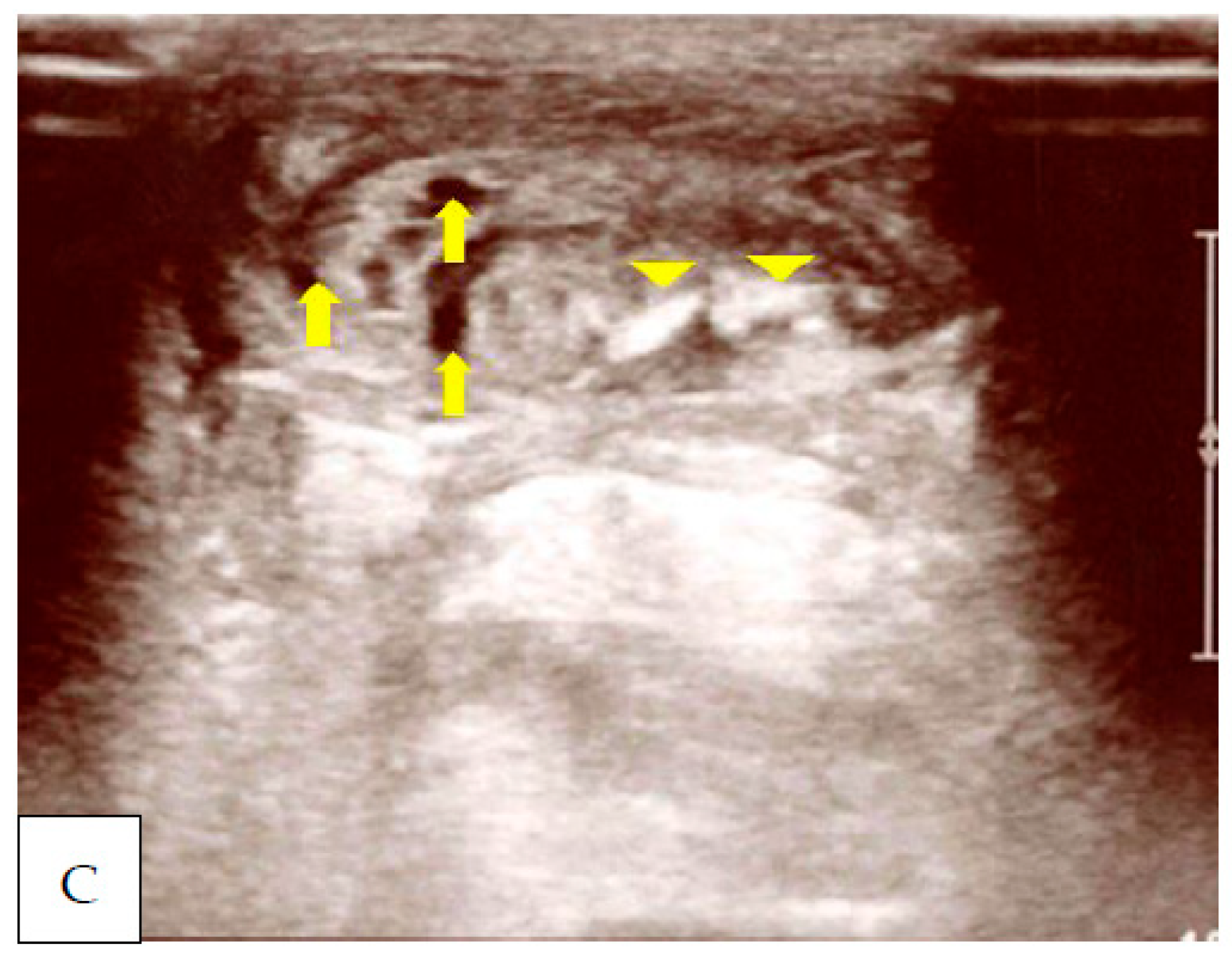 Ijerph 20 05985 g004b