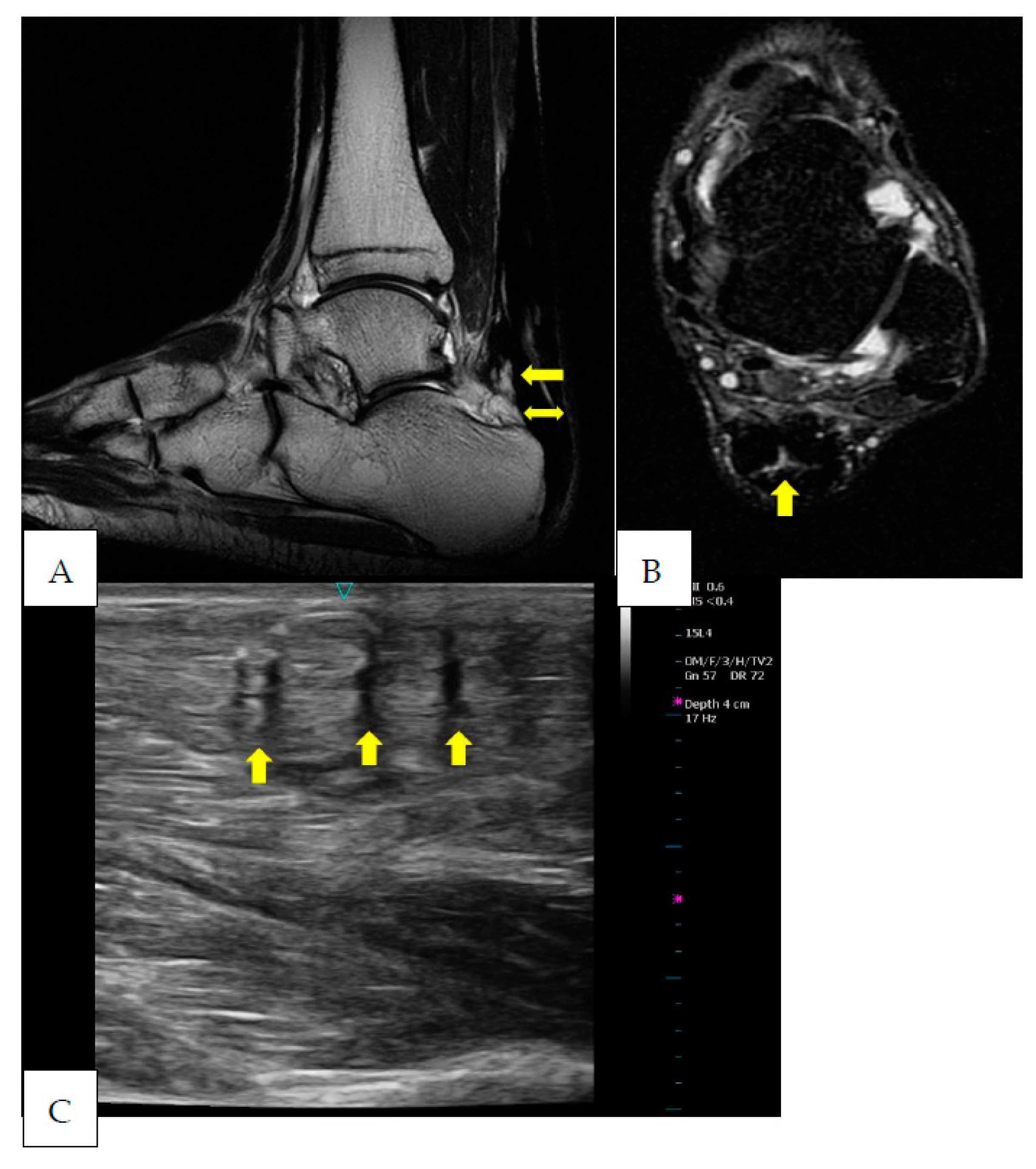 Ijerph 20 05985 g005
