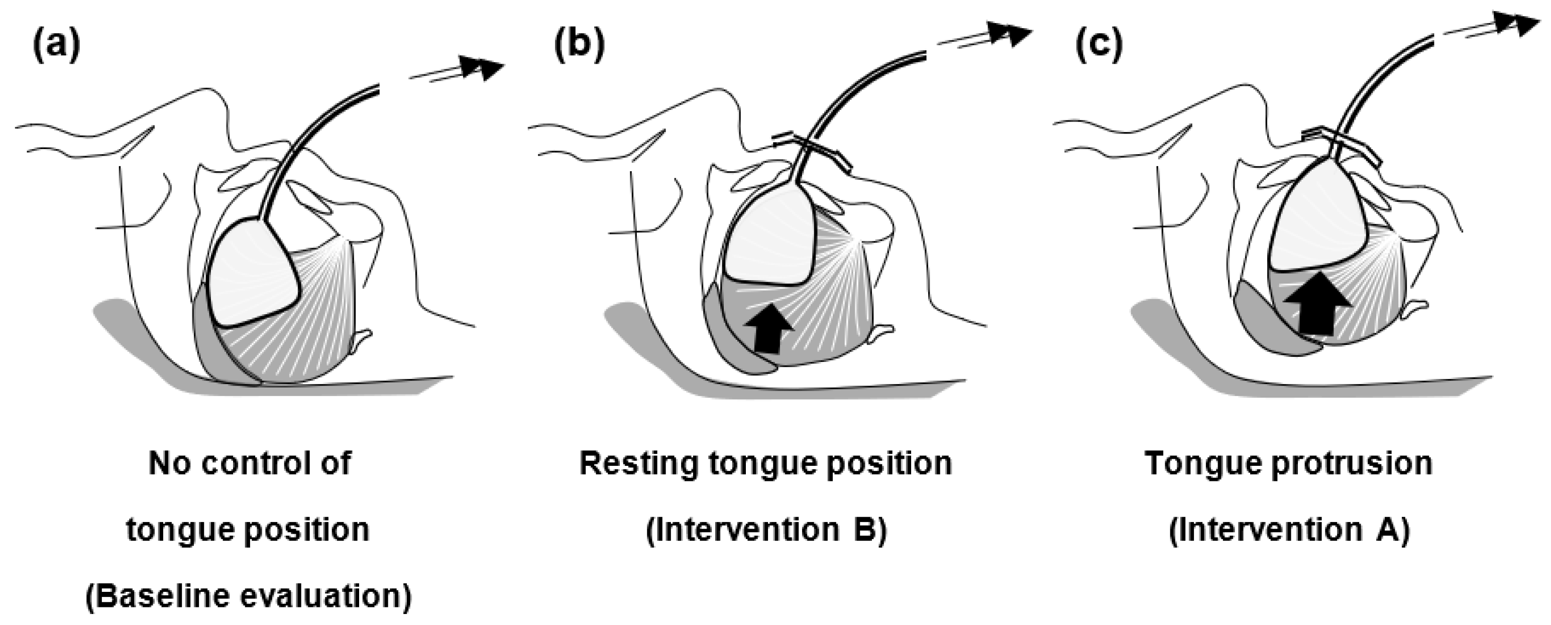 IJERPH | Free Full-Text | Control of Tongue Position in Patients with ...