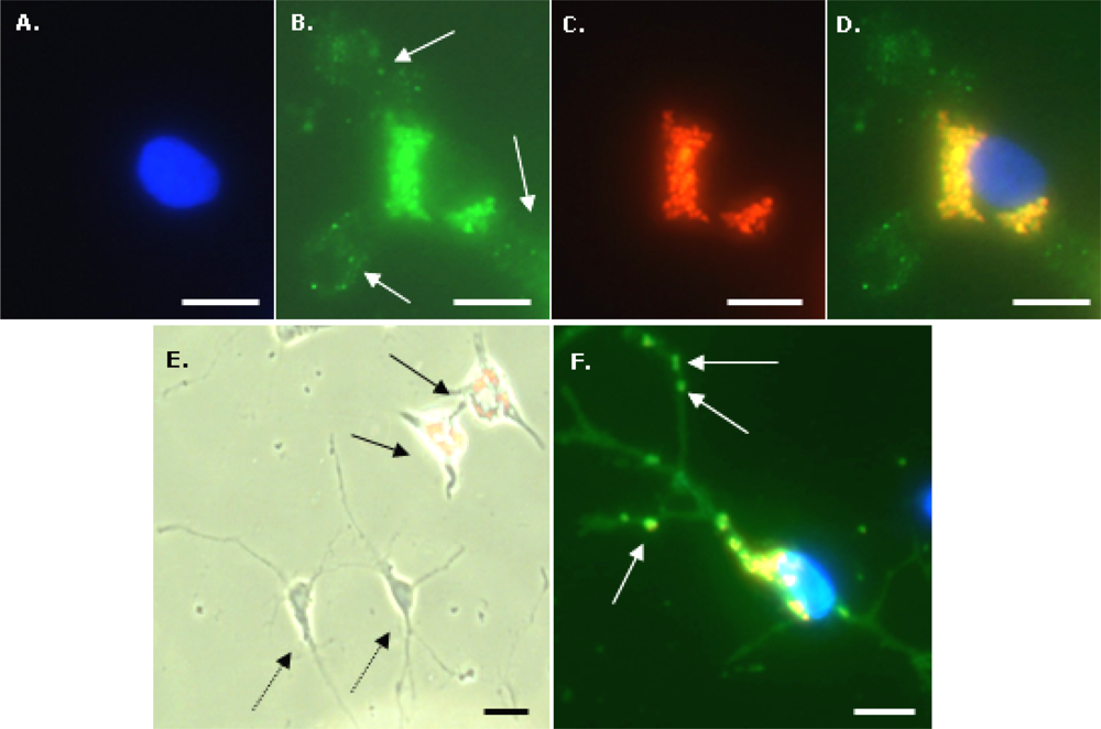 Ijms 11 00967f2 1024