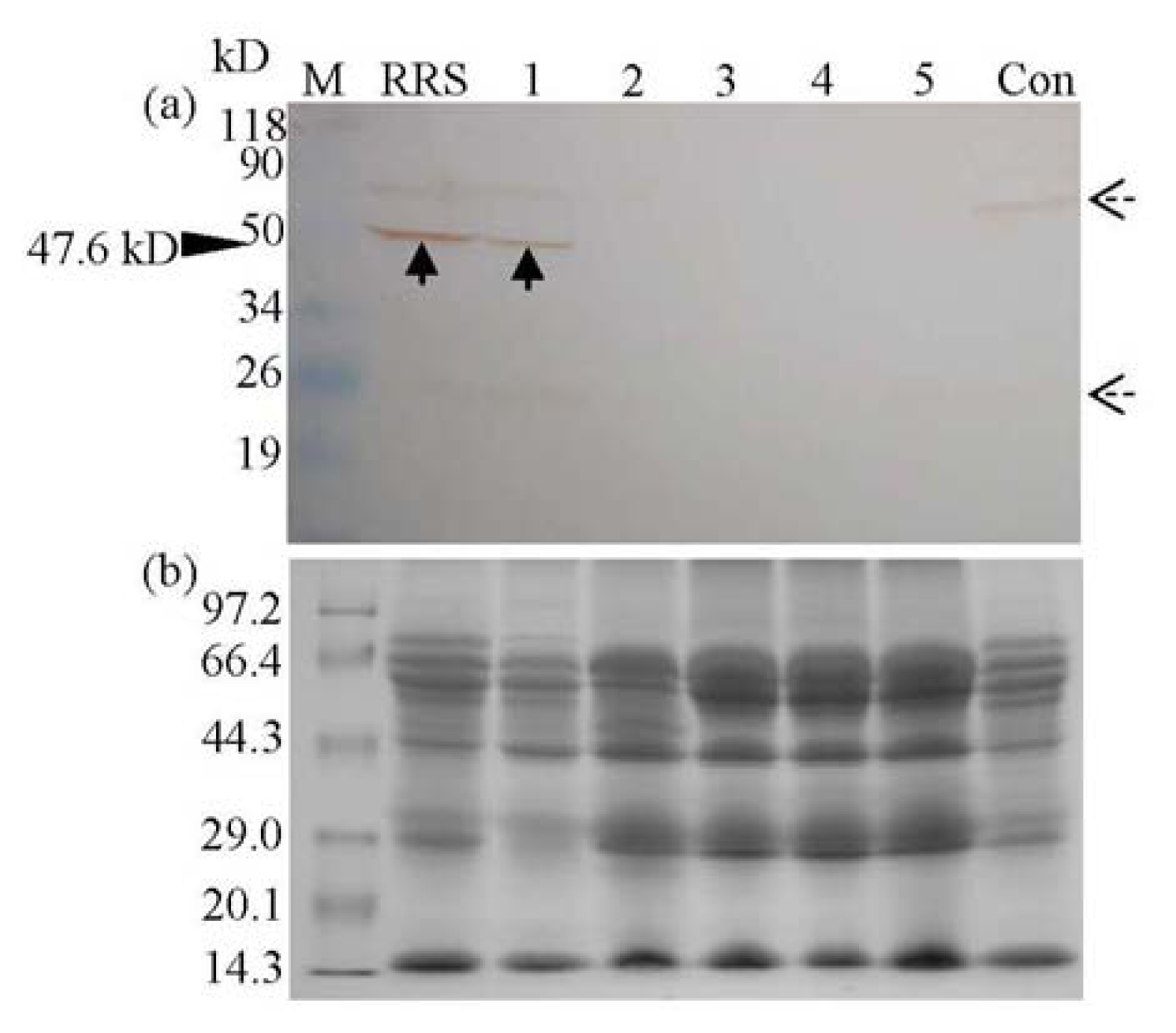 Ijms Free Full Text Presence Of Cp4 Epsps Component In Roundup Ready Soybean Derived Food Products Html