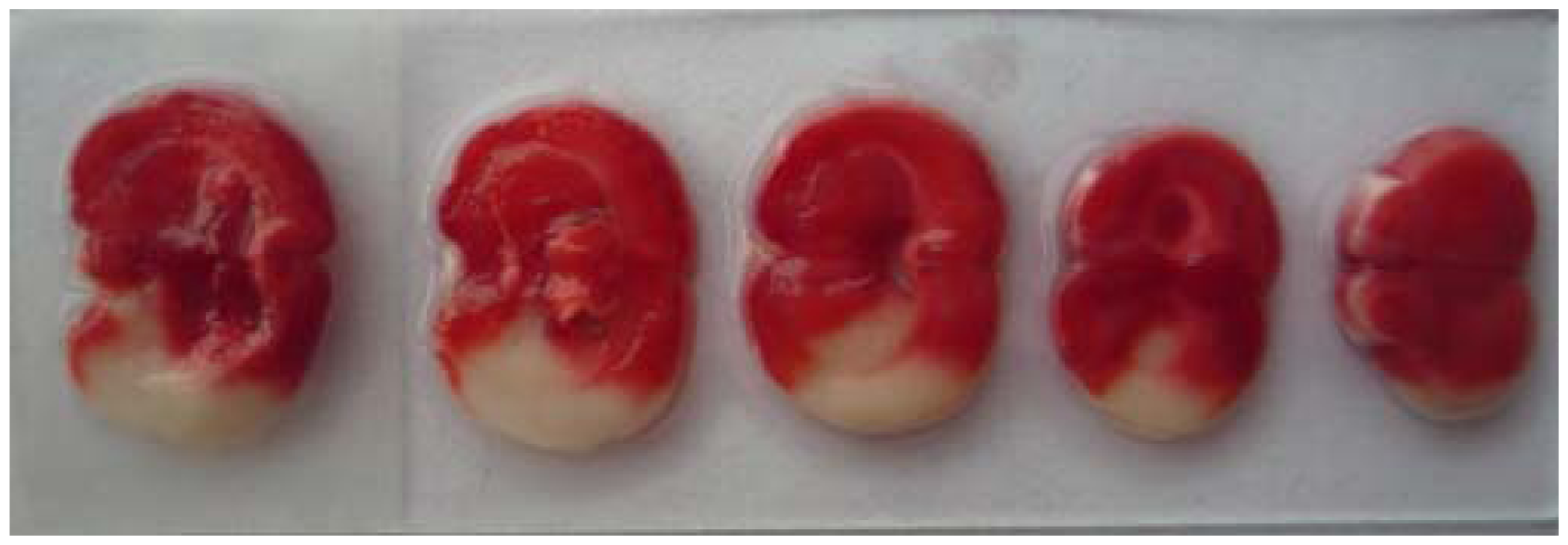 Ijms 13 02551f1 1024