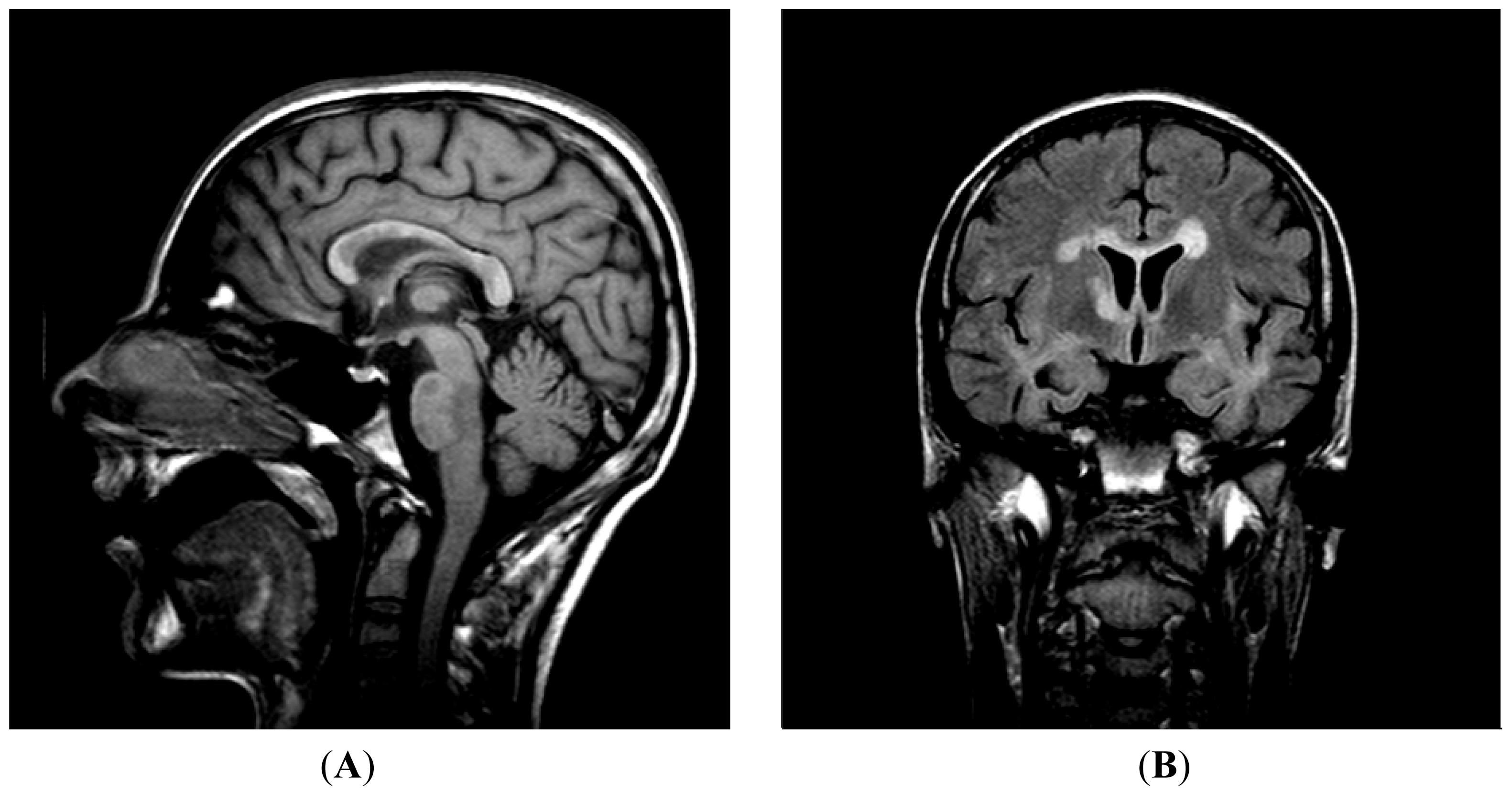 Ijms 13 07676f4 1024