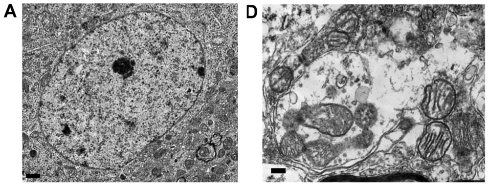 Ijms 13 08722f4a 1024