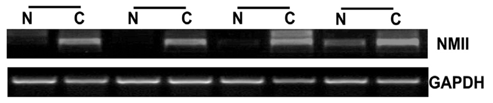 Ijms 13 15291f1