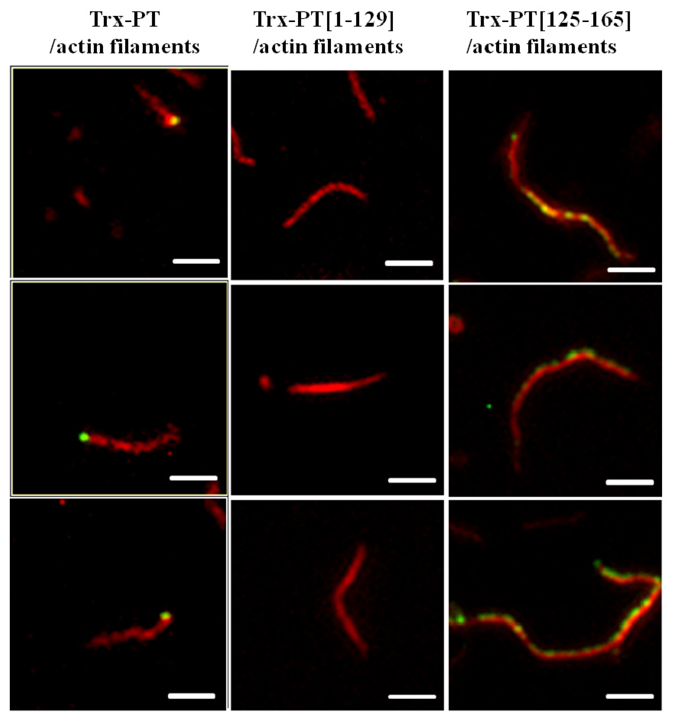 Ijms 13 15967f3 1024