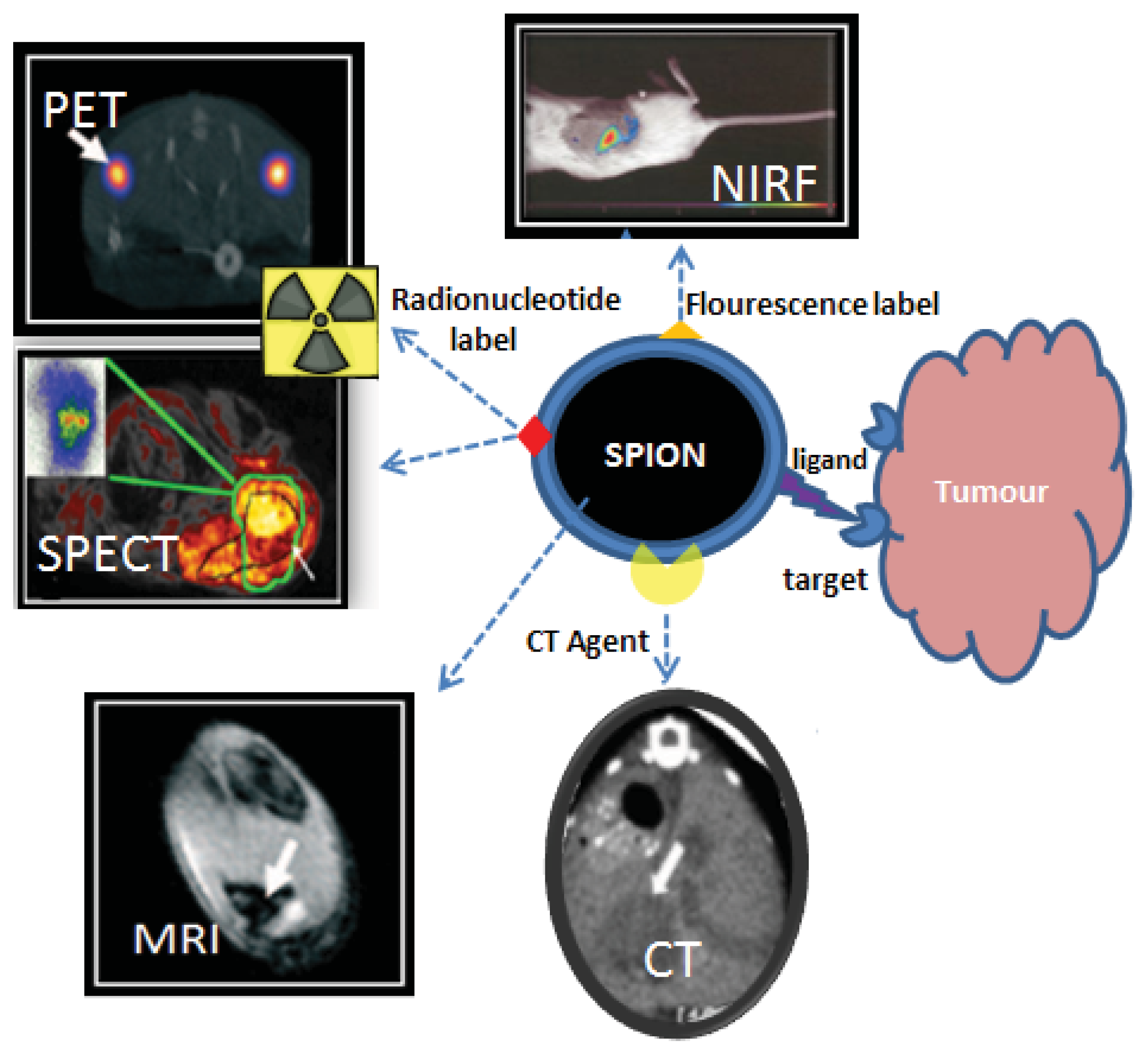 can breast cancer go to kidneys