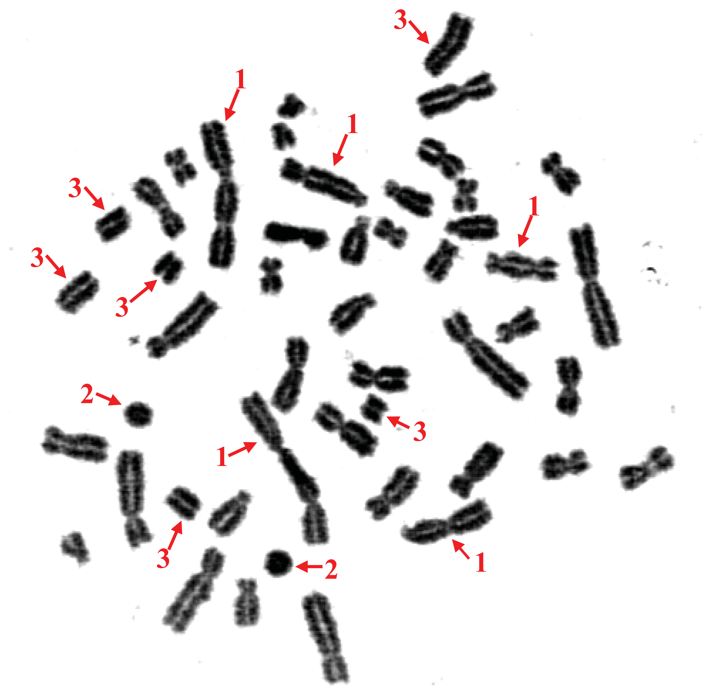 PDF) Clinical, cytogenetic, and molecular findings in a patient with ring  chromosome 4: case report and literature review