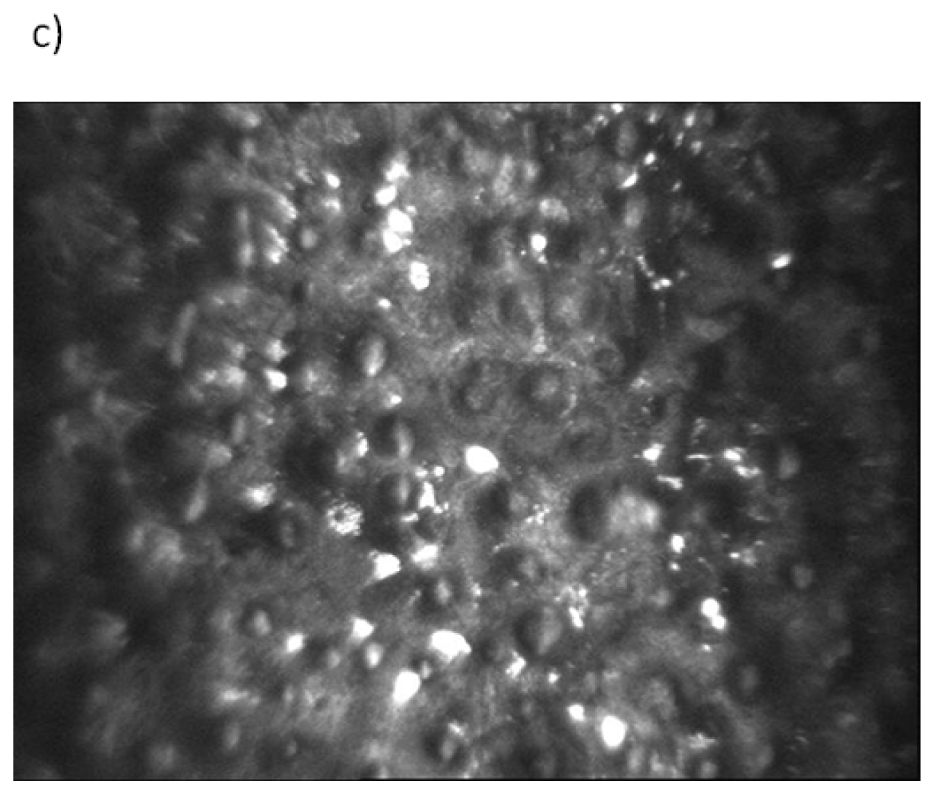 IJMS Free FullText Oxidative Stress in the Pathogenesis of