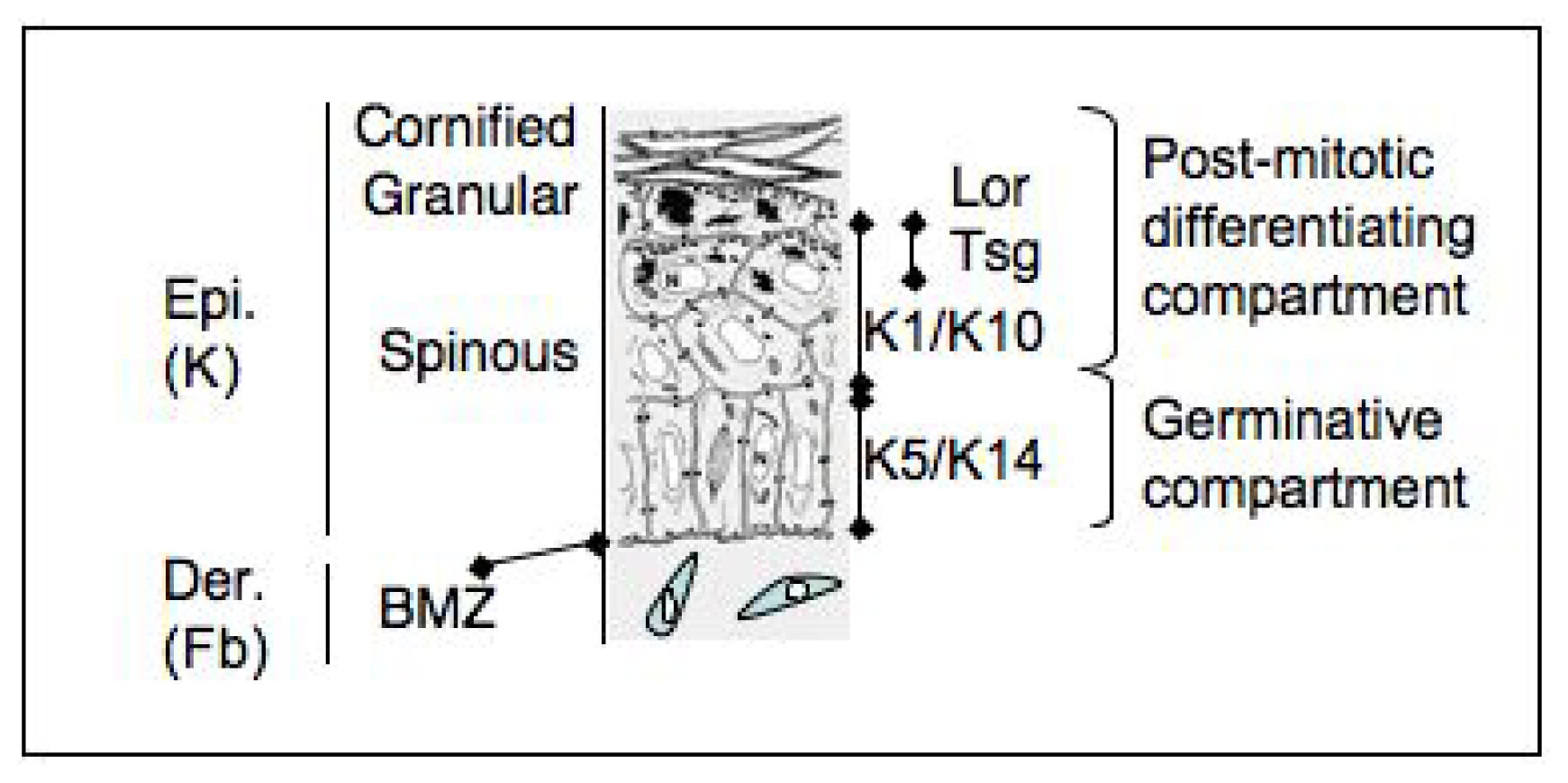 Treatment Xeroderma Pigmentosum / What Is Xeroderma Pigmentosum Pt
