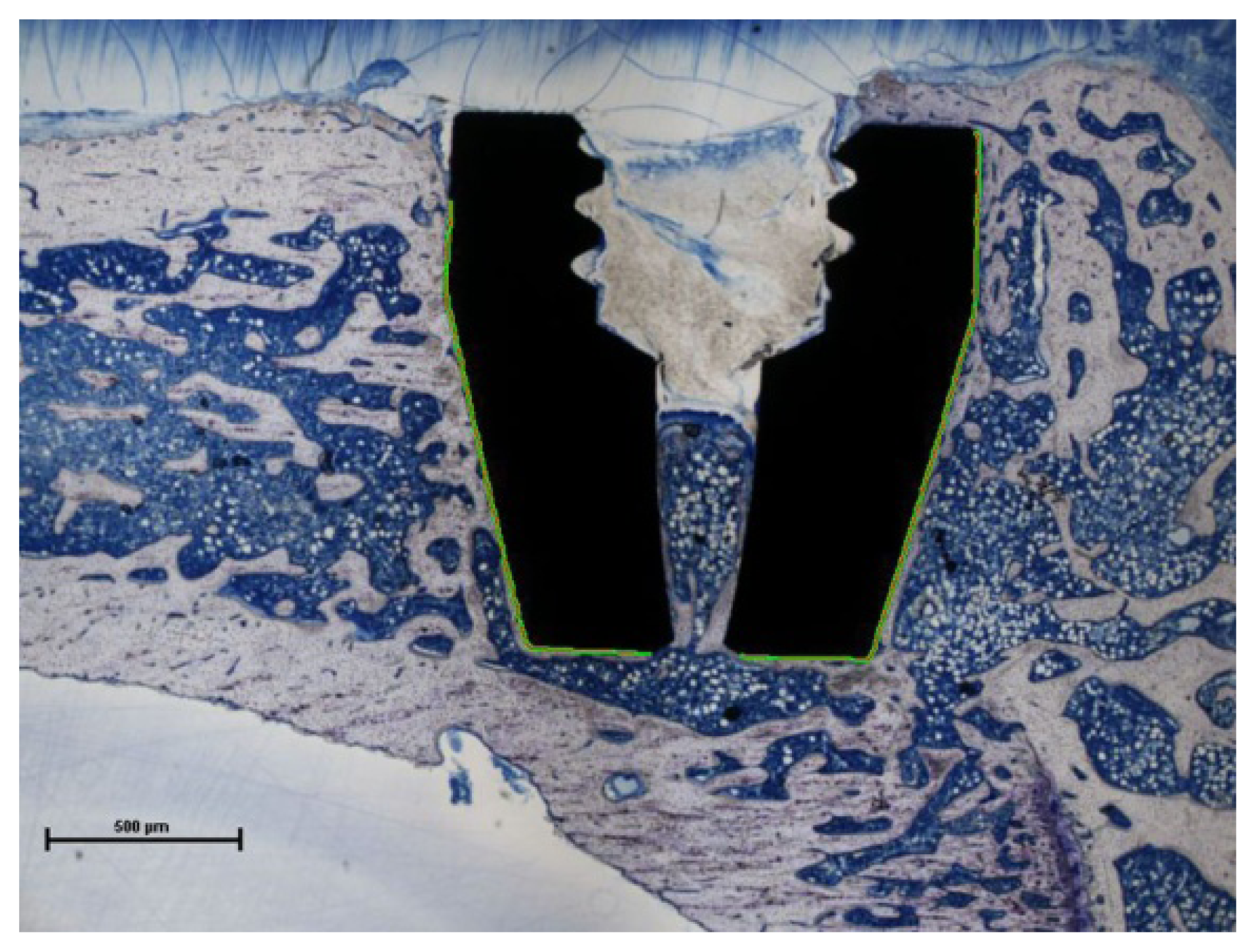 Ijms 15 02454f4 1024