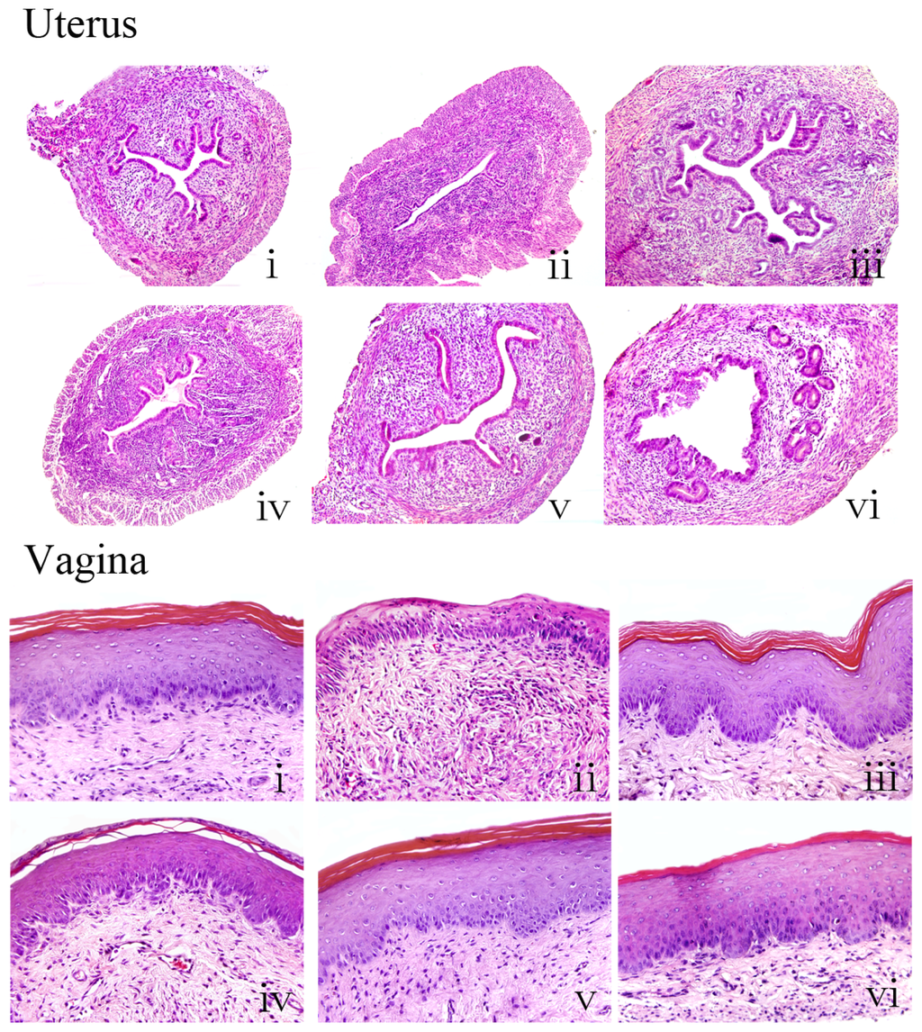 Vaginal epithelium