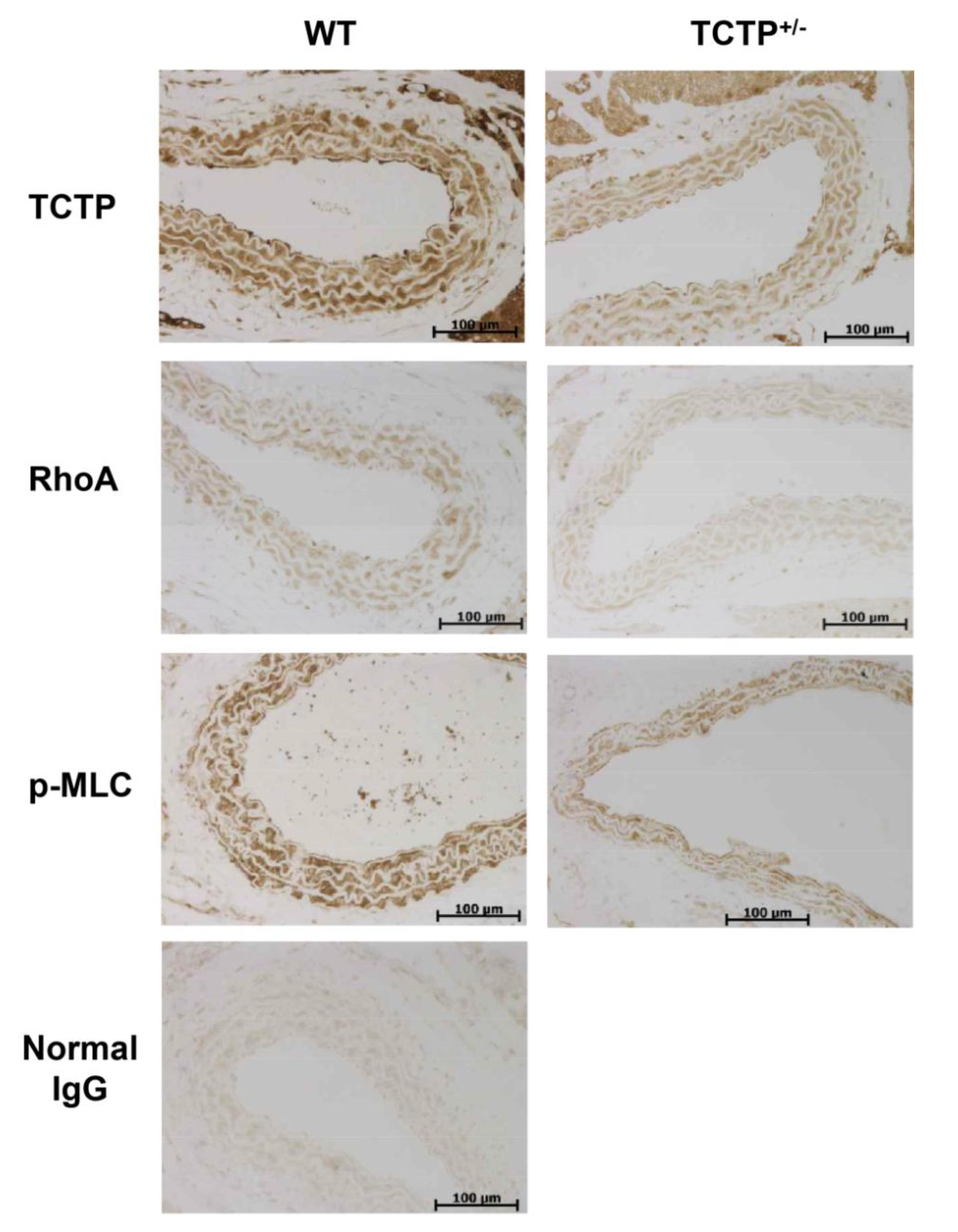 Ijms 15 10365 g003 1024