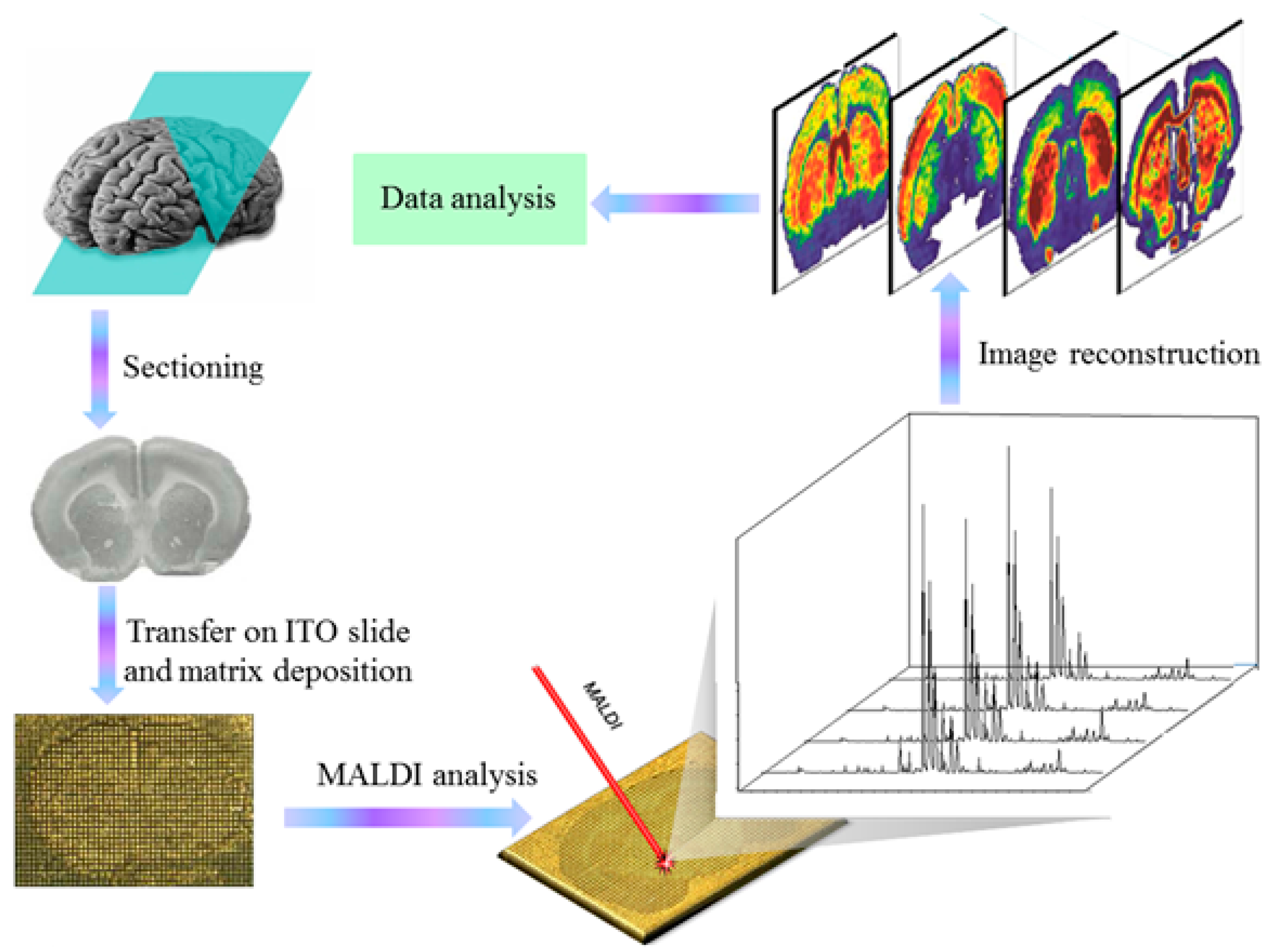 バスストップ（6巻セット） Mass Spectrometry Methodology in Lipid Analysis