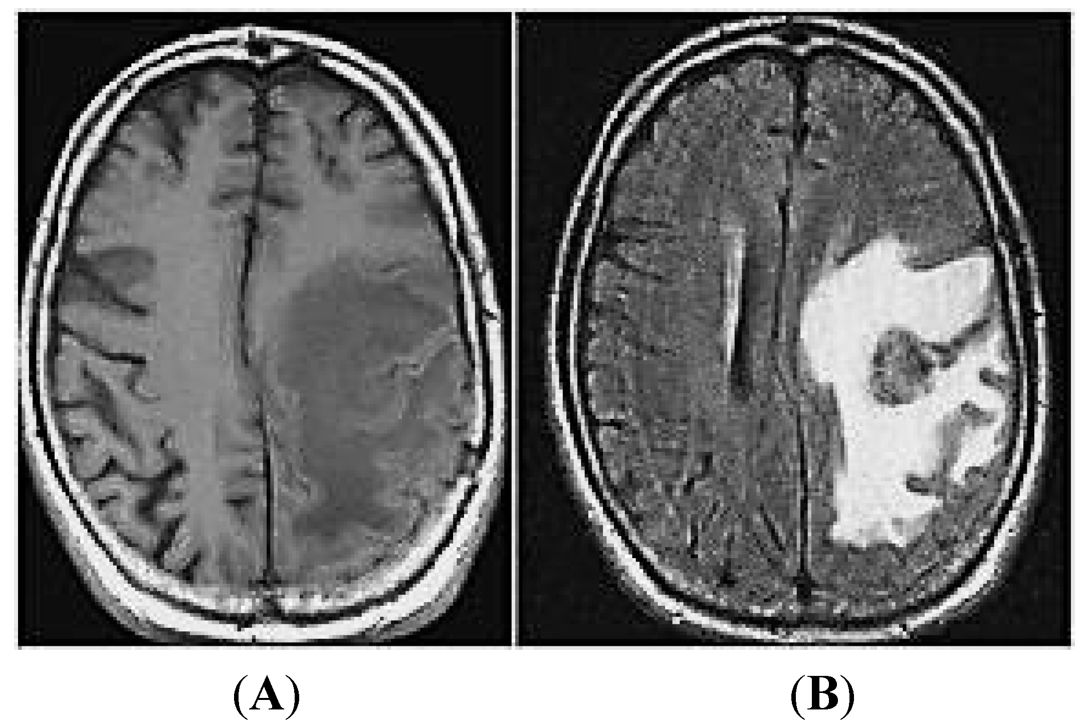 Ijms 15 10508 g002 1024