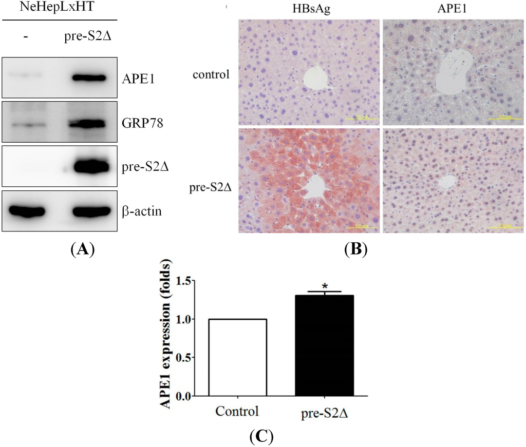 Induction of Apurinic Endonuclease 1 Overexpression by Endoplasmic