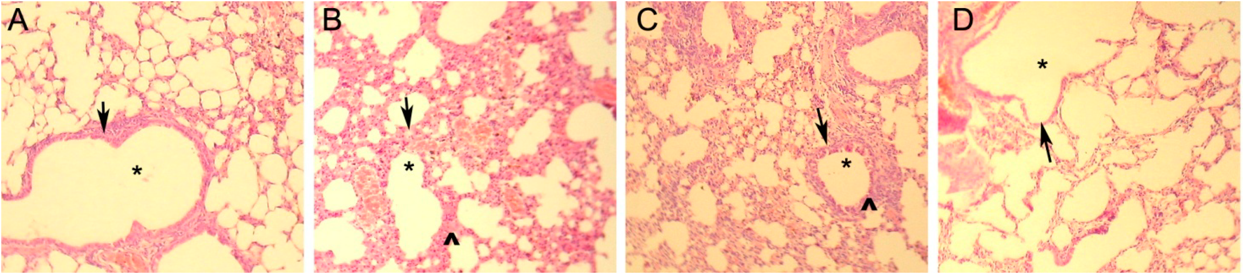 Ijms 15 15304 g002
