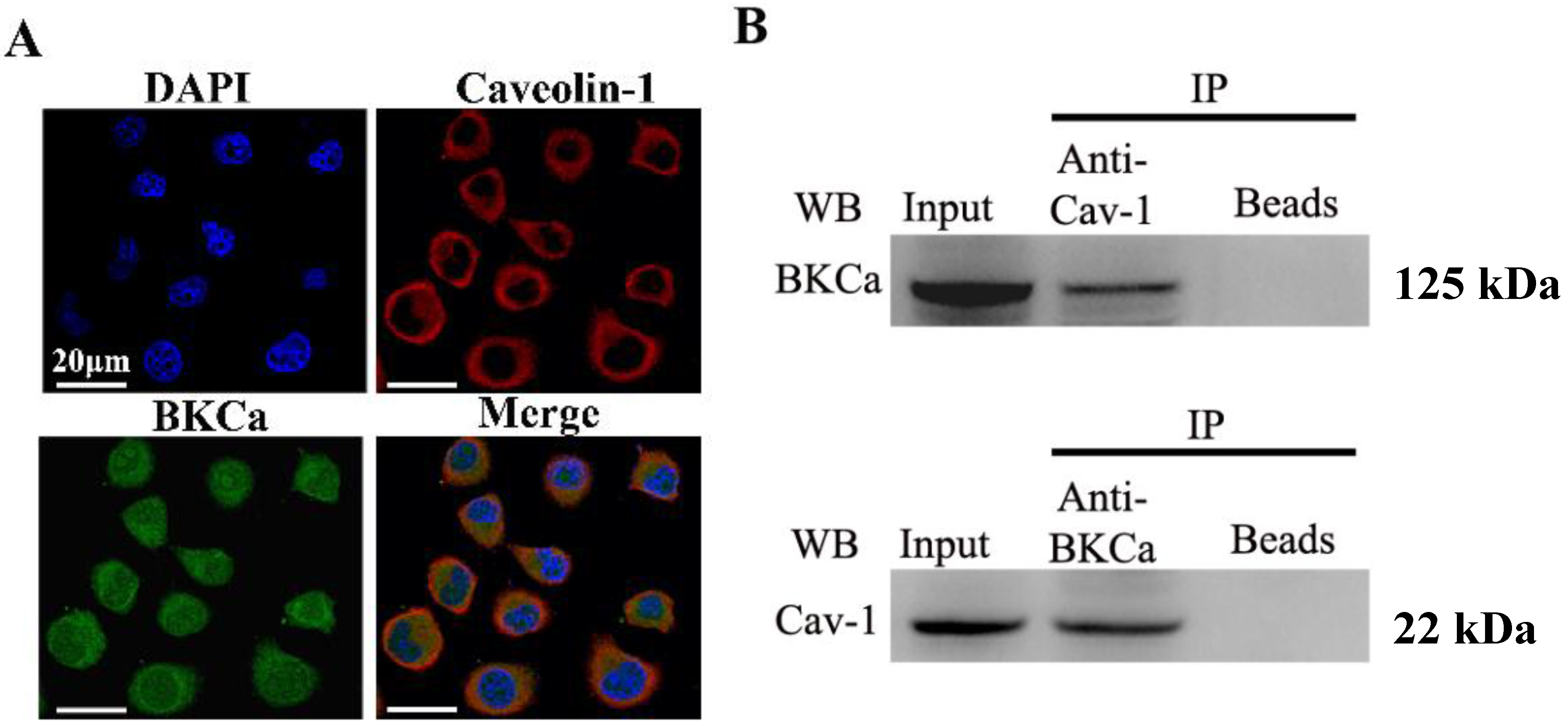 Caveolin-1 Limits the Contribution of BKCa Channel to MCF-7 Breast Cancer Cell Proliferation and Invasion