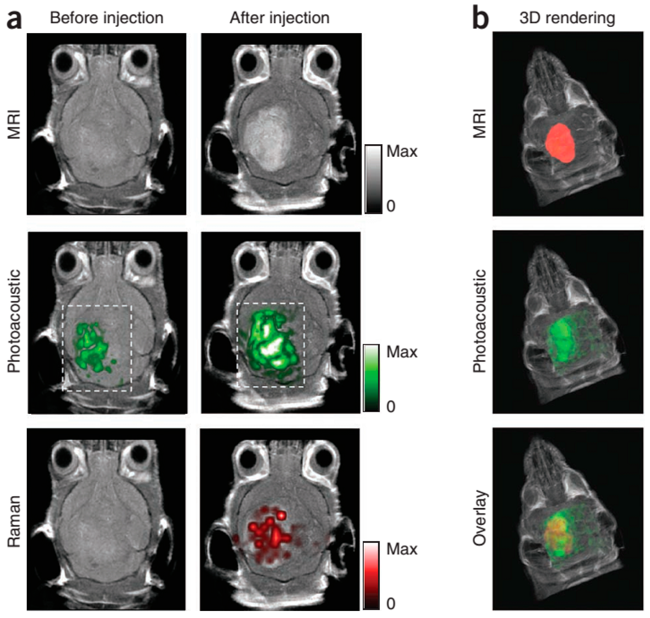 Central Florida College >> IJMS | Free Full-Text | Contrast Agents for Photoacoustic and Thermoacoustic Imaging: A Review Central Florida College >> IJMS | Free Full-Text | Contrast Agents for Photoacoustic and Thermoacoustic Imaging: A Review