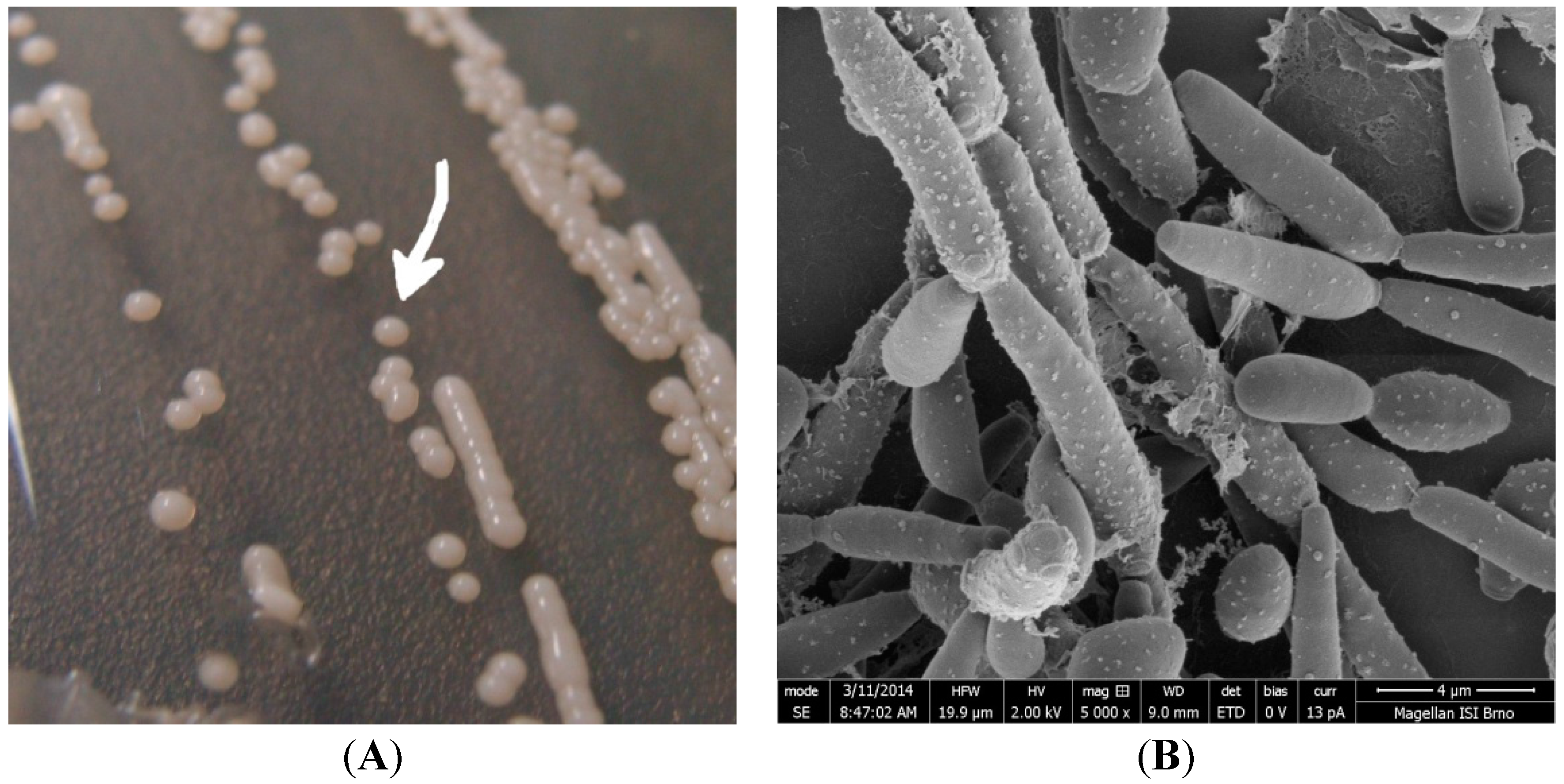 IJMS | Free Full-Text | Candida parapsilosis Biofilm Identification by