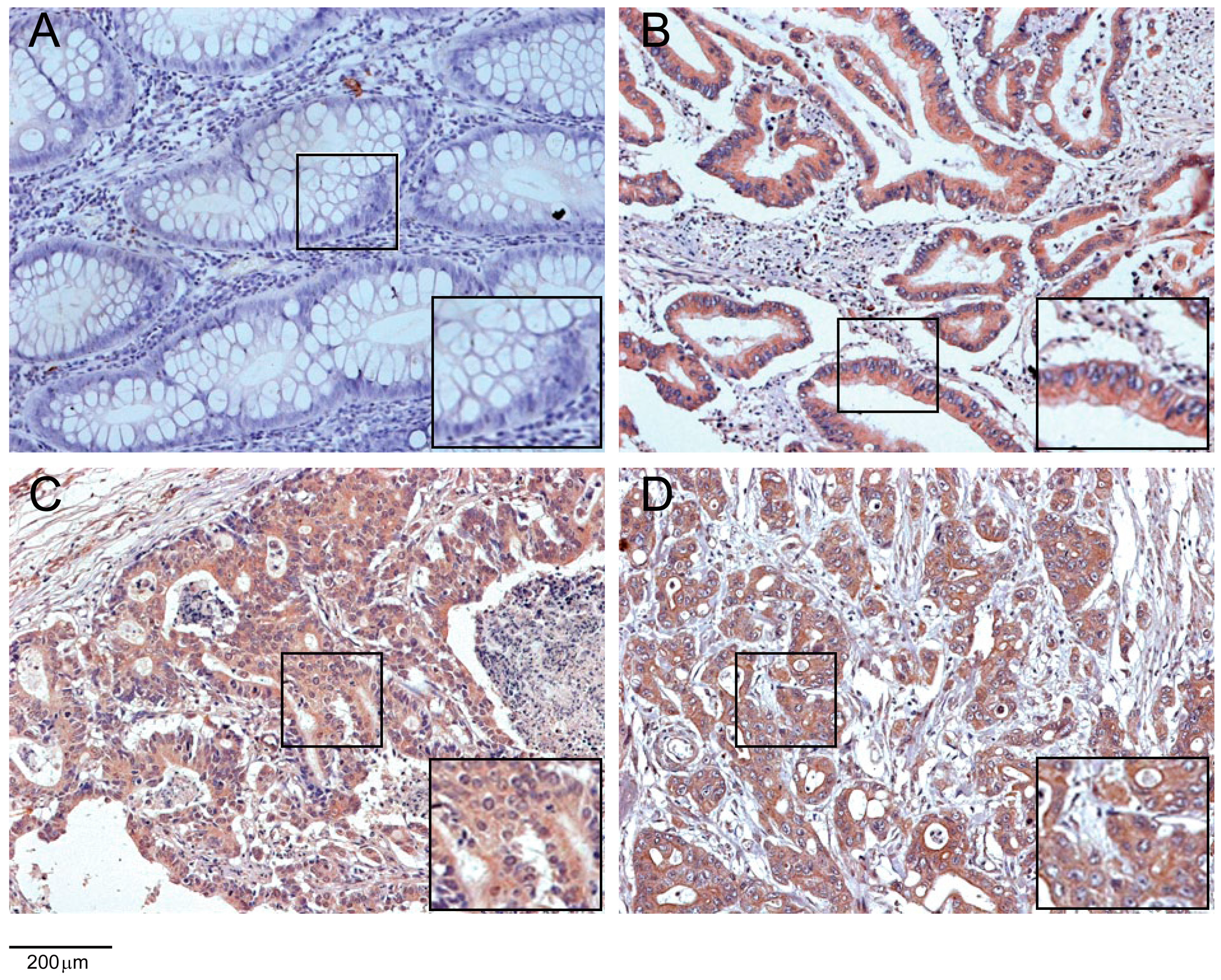 Ijms 16 00691 g004 1024