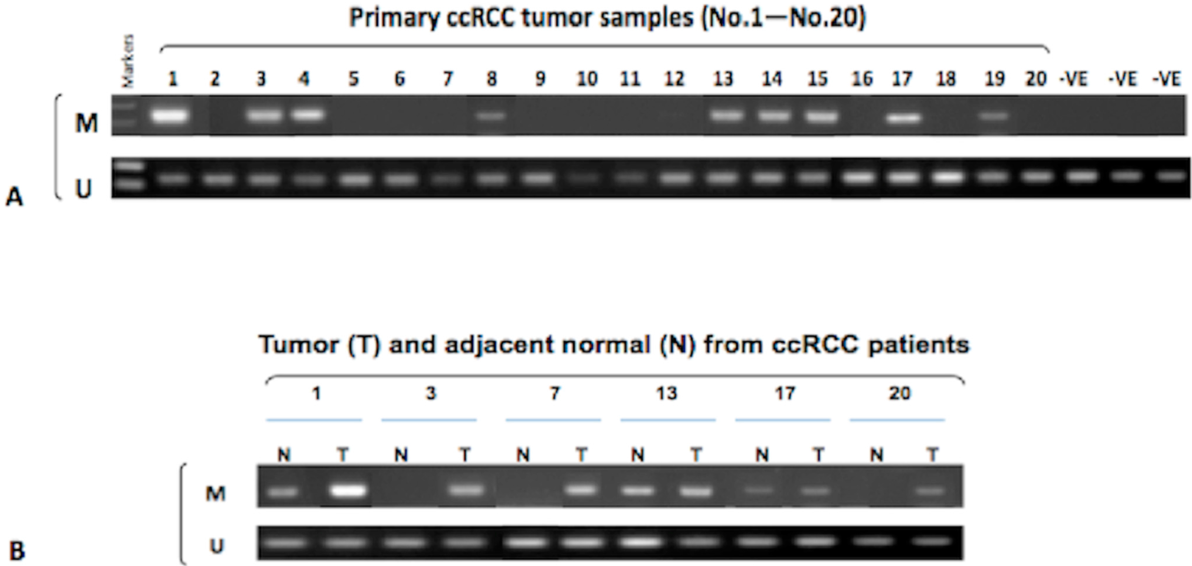Ijms 16 01051 g003 1024