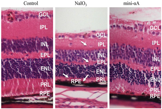 IJMS | Free Full-Text | Protection of Retina by Mini-αA in NaIO3