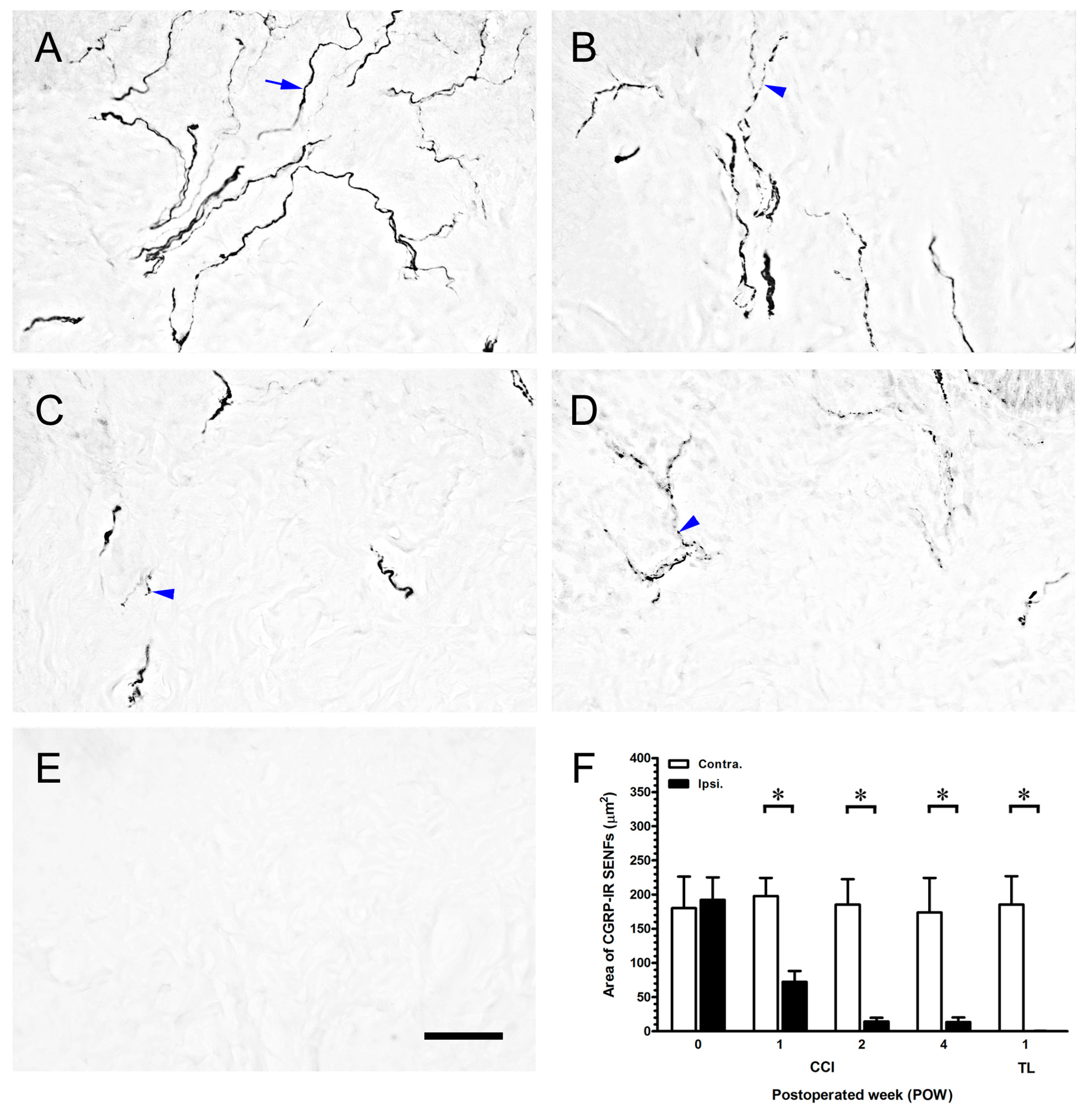 IJMS | Free Full-Text | Nerve Demyelination Increases Metabotropic 