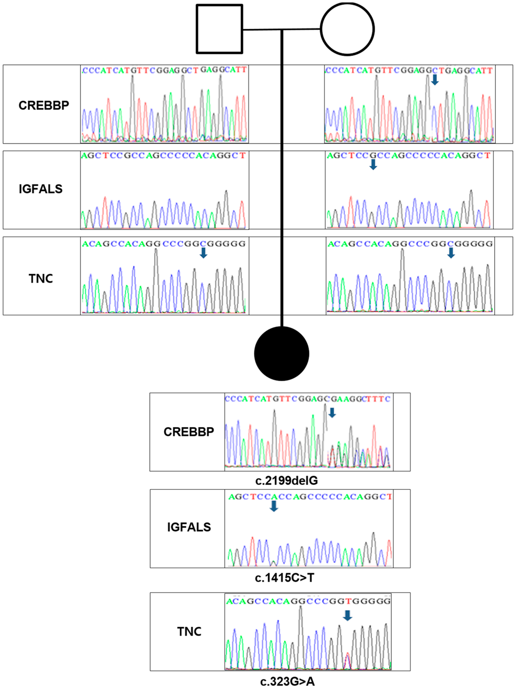 Molecular studies in 10 cases of Rubinstein-Taybi syndrome, including a  mild variant showing a missense mutation in codon 1175 of CREBBP