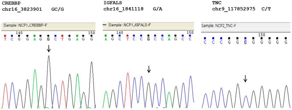 PDF) Identification of a novel de novo mutation of CREBBP in a patient with  Rubinstein-Taybi syndrome by targeted next-generation sequencing: A case  report