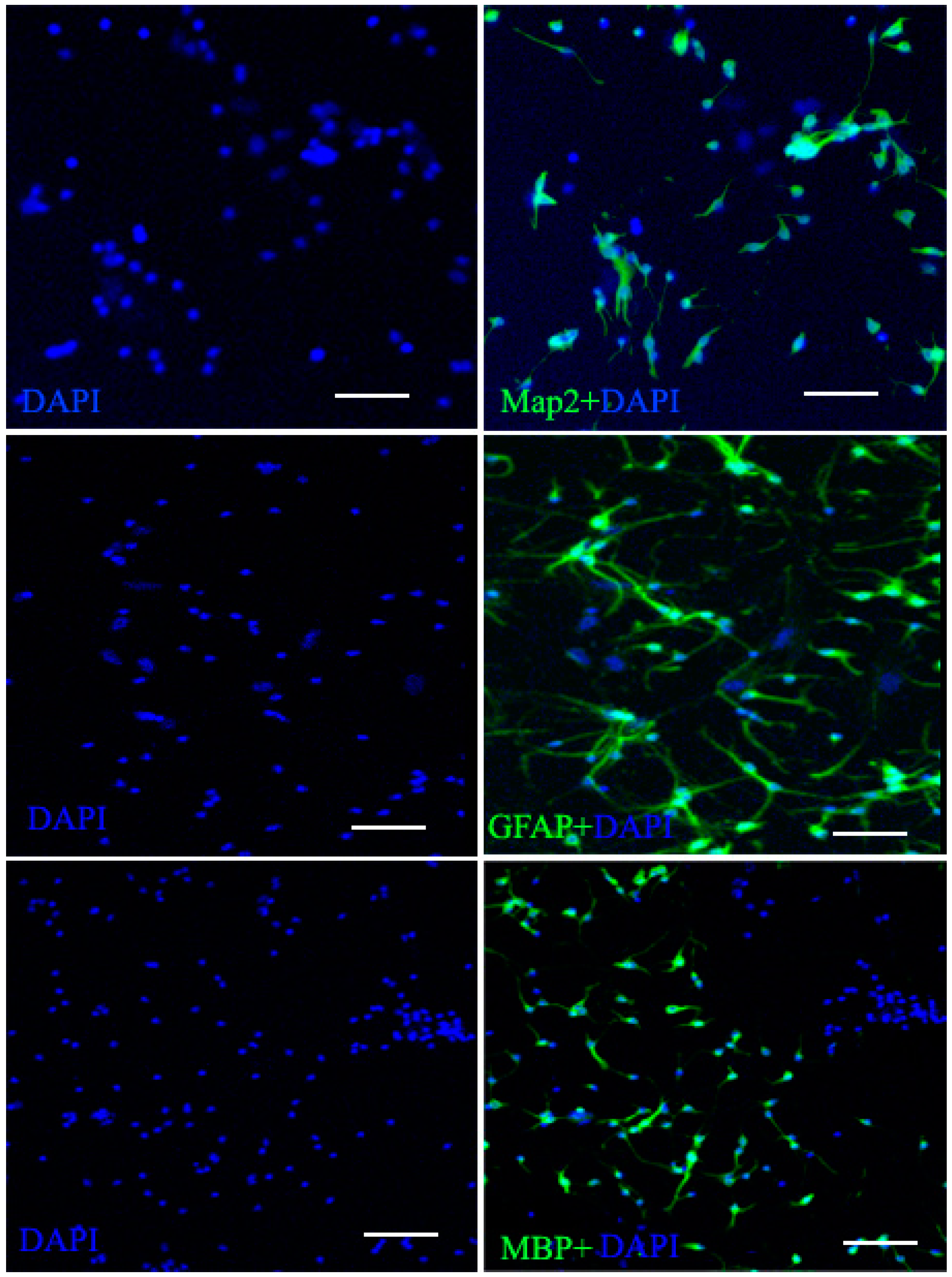 Ijms 16 05990 g003 1024