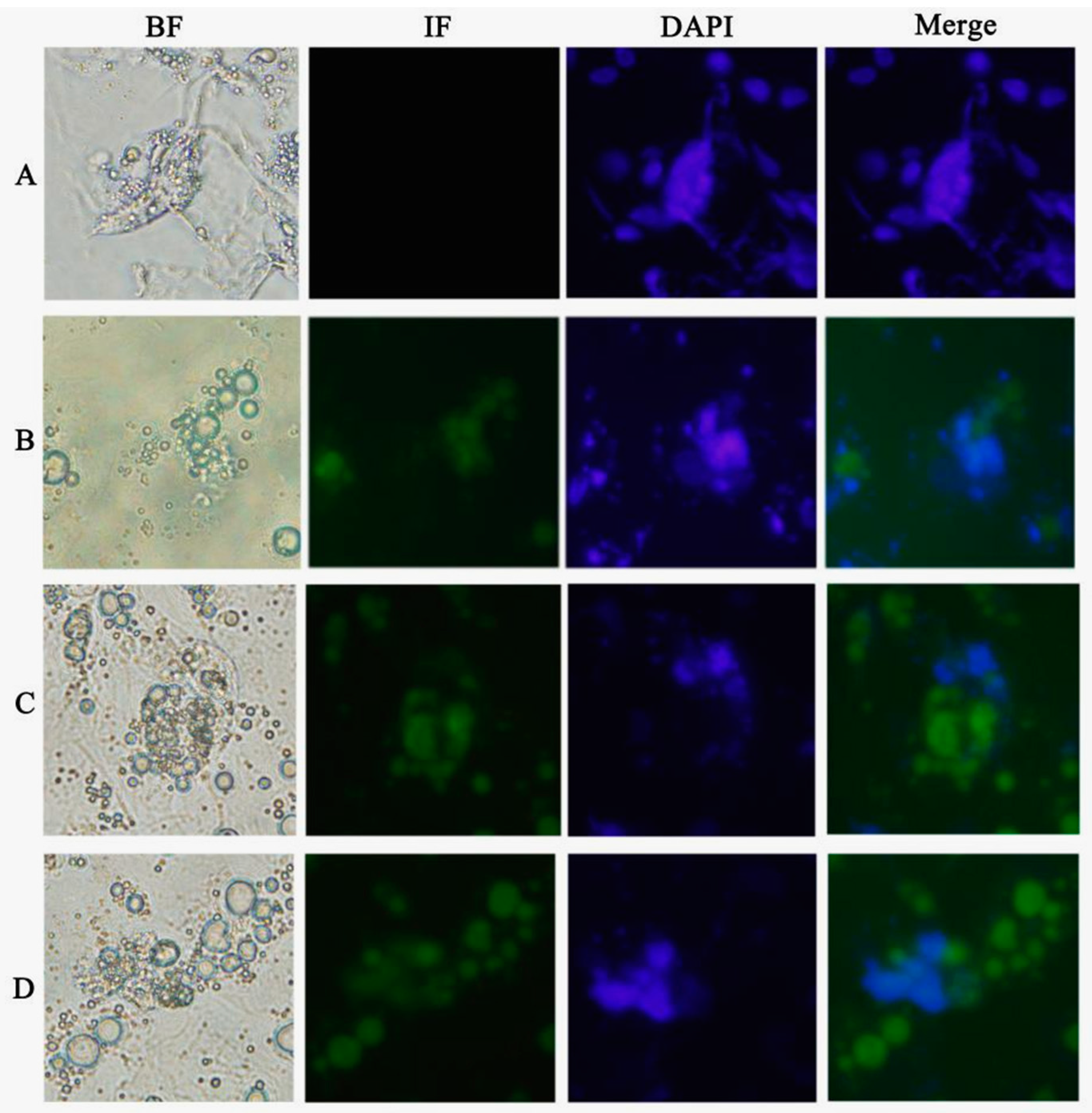 Ijms 16 06595 g004 1024