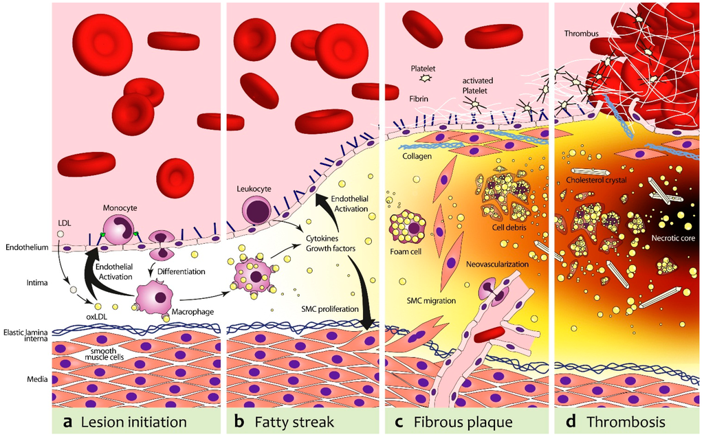 IJMS | Free Full-Text Imaging for Risk Assessment | HTML