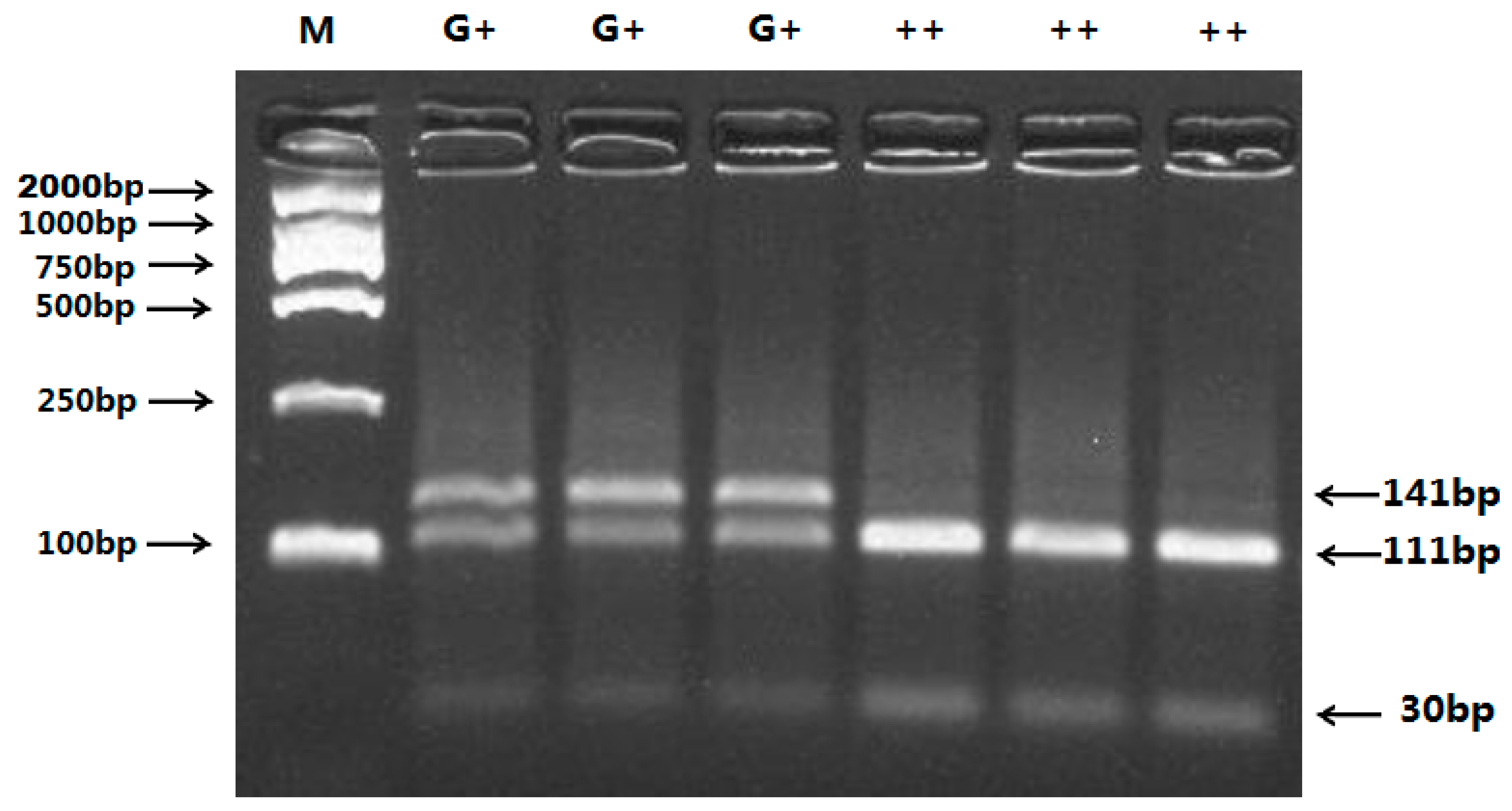 Ijms 16 11385 g002