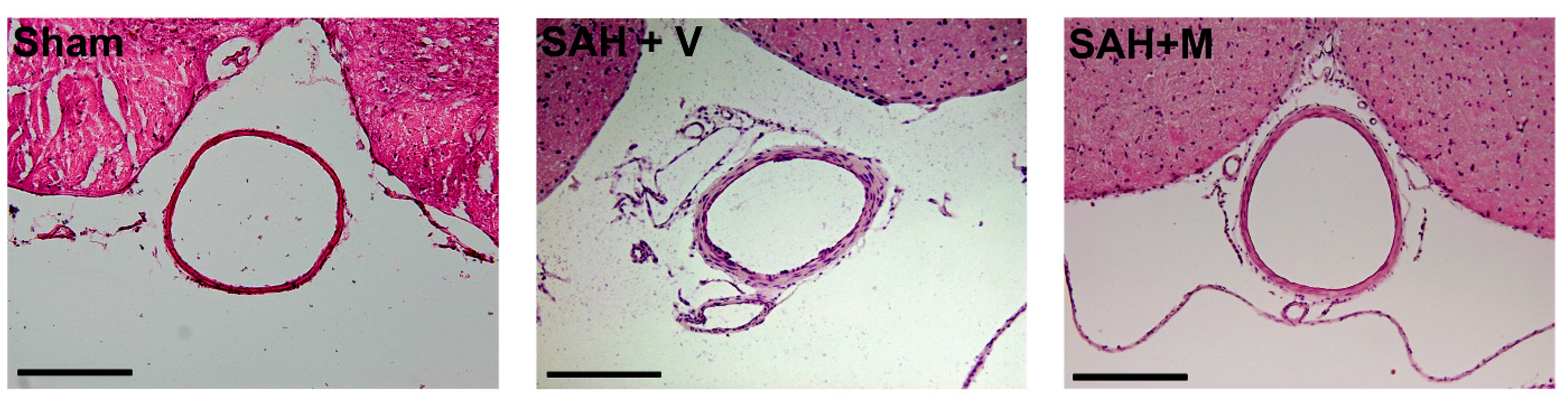 Ijms 16 14171 g001 1024