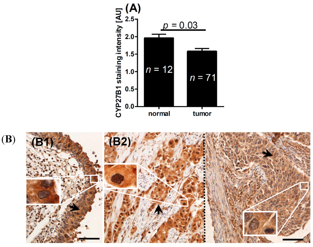 IJMS Free FullText Expression of Vitamin D Receptor (VDR) Positively Correlates with