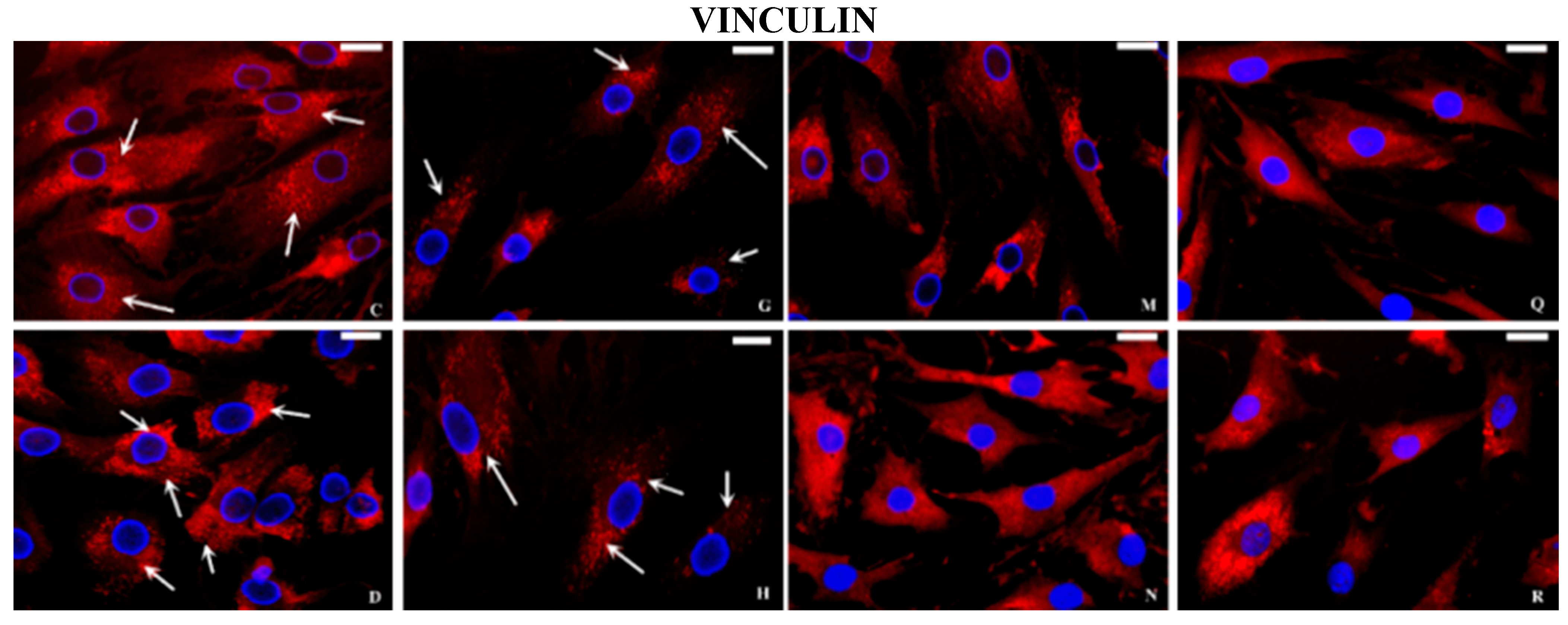 Ijms 16 25936 g005b 1024